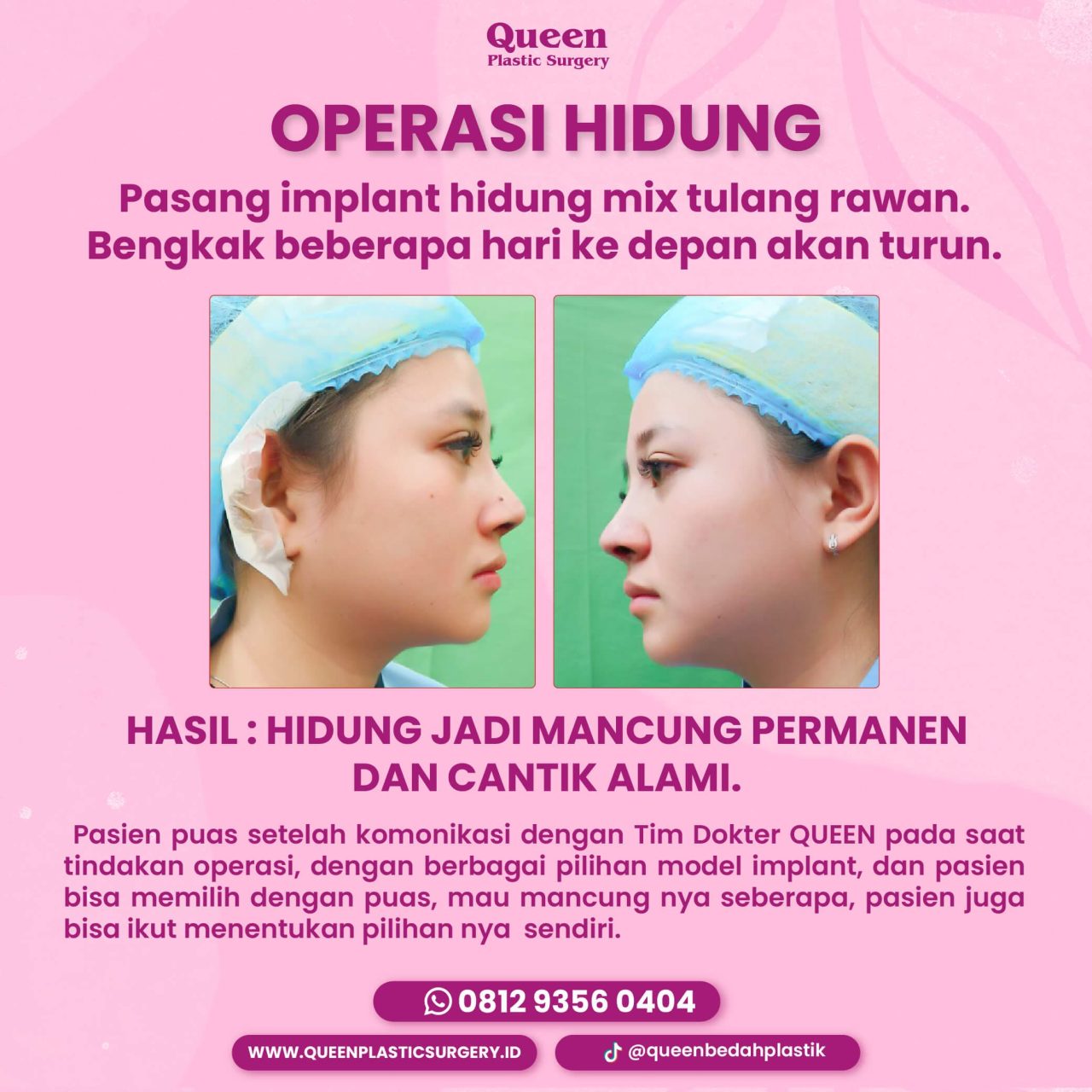 8 IGF 4723