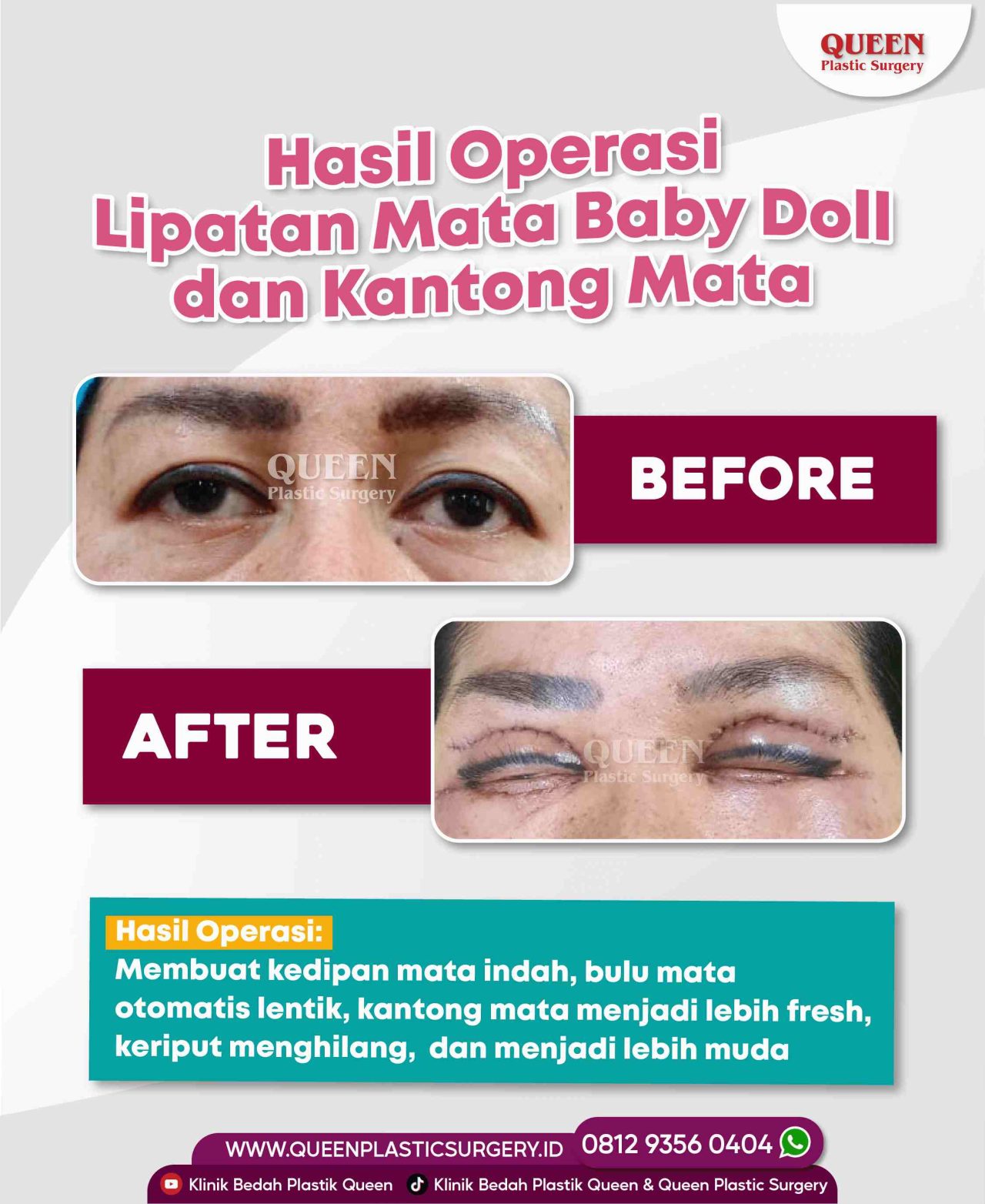 8 SEPTEMBER 2022-07-fotor-20240130112317