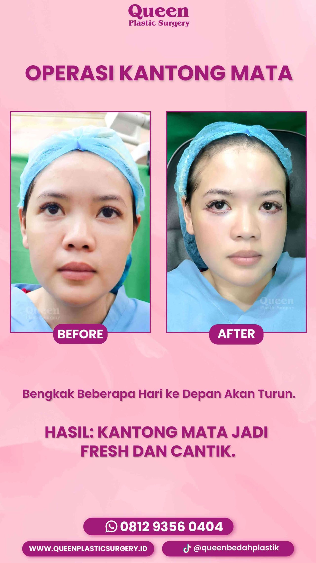 83 IGS -fotor-20240130114419