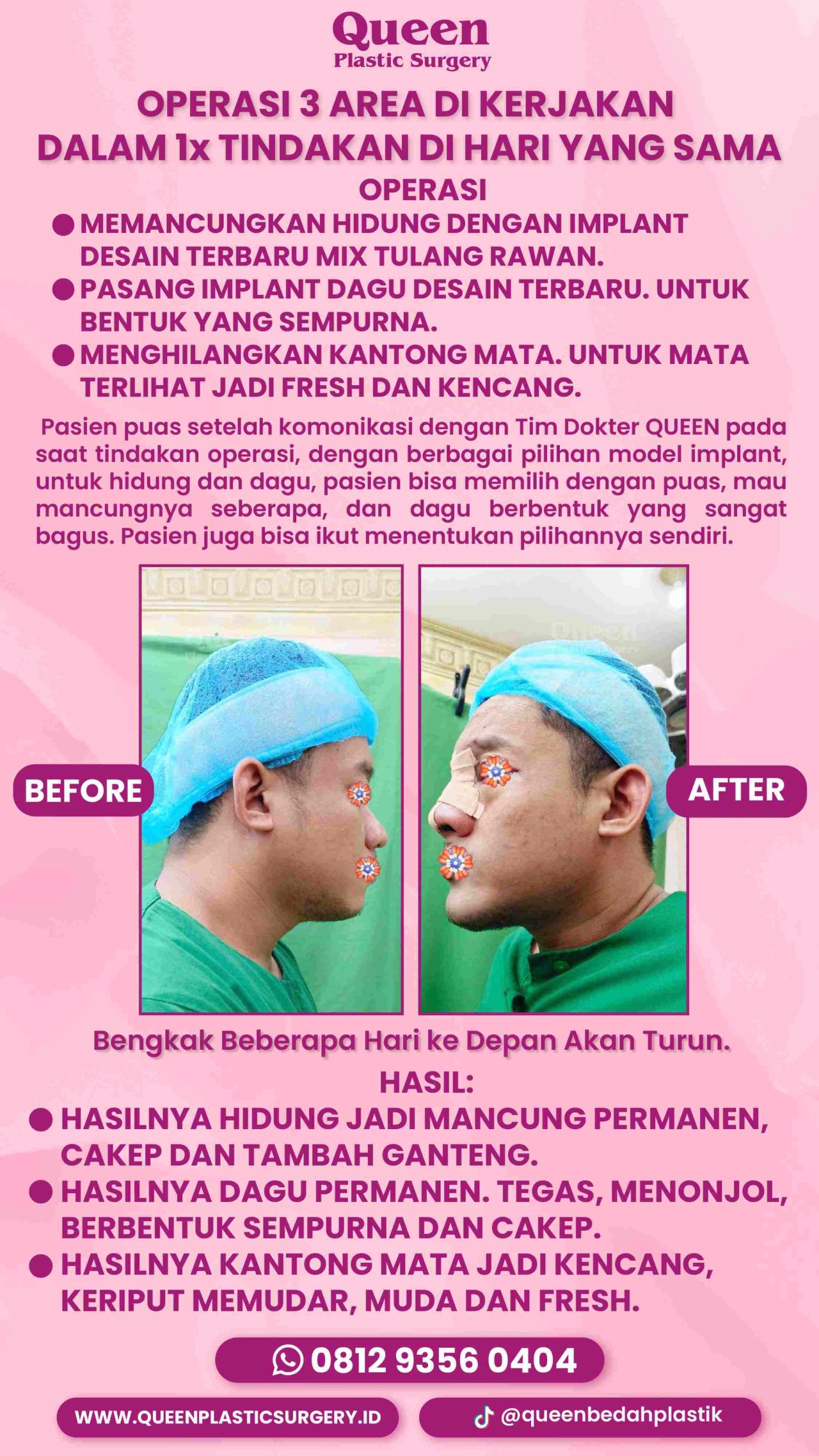84 IGS -fotor-20240129151953