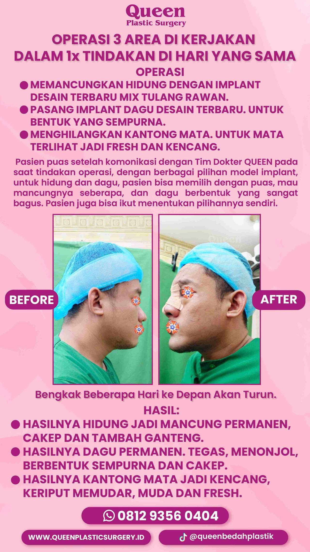 84 IGS -fotor-20240130112442