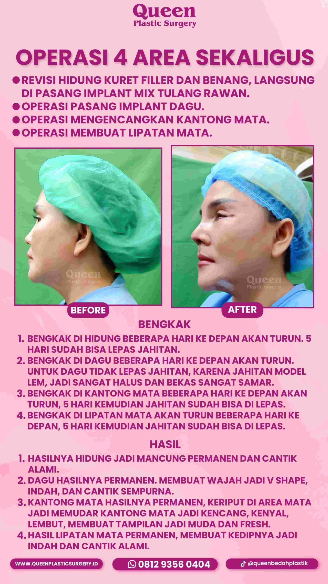 86 IGS -fotor-20240129151940