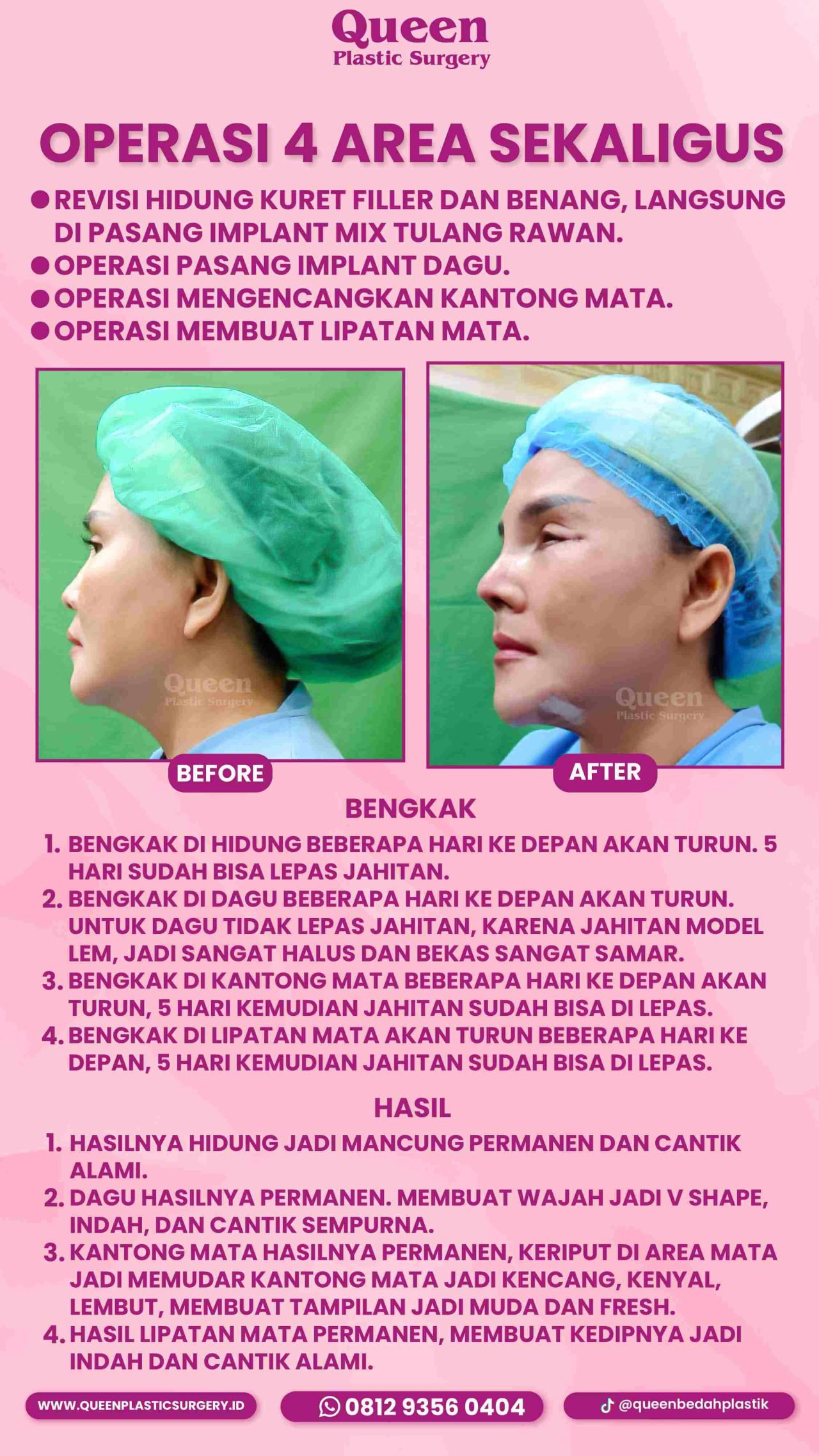 86 IGS -fotor-20240130112356