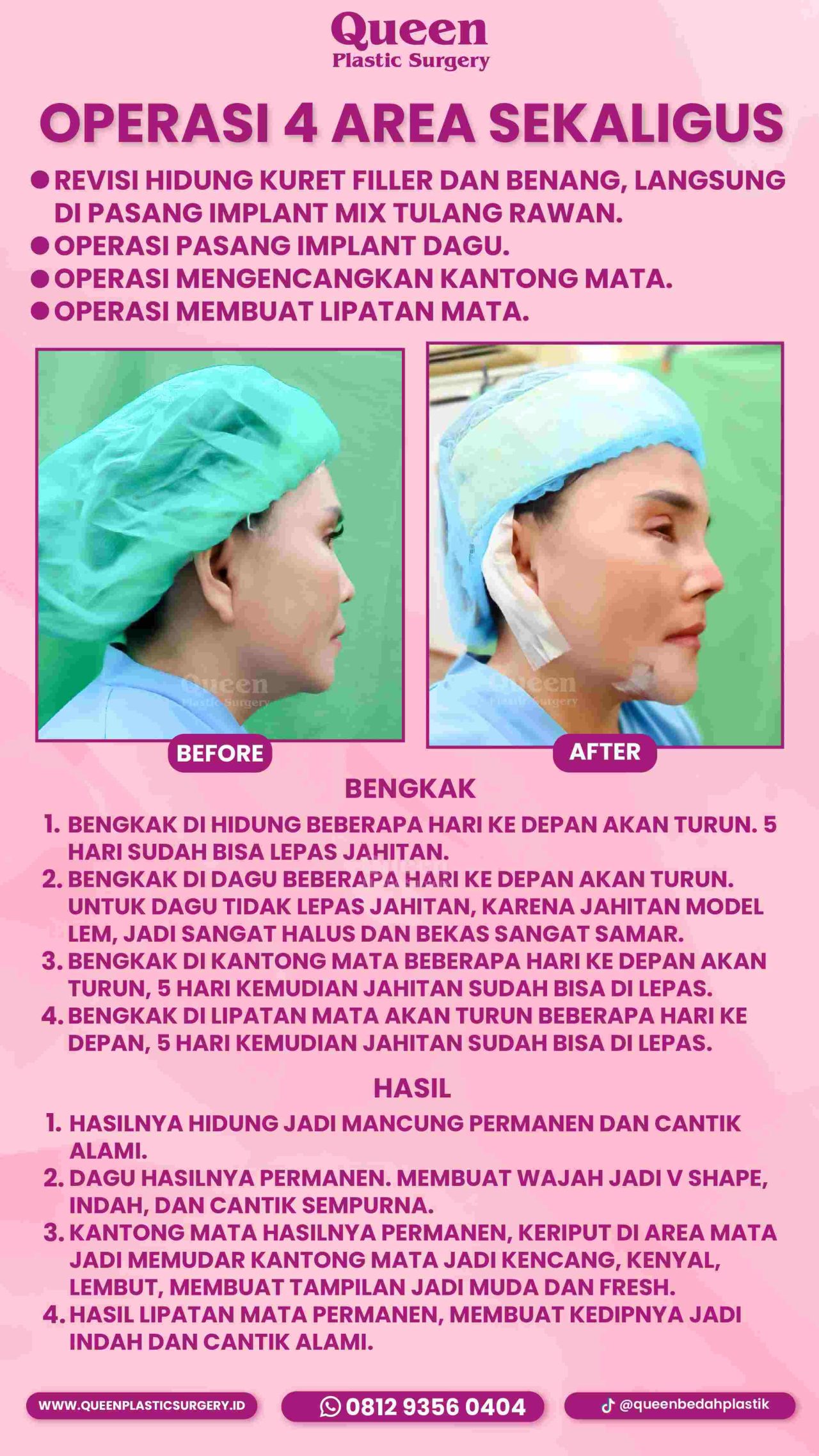 87 IGS -fotor-20240130113331