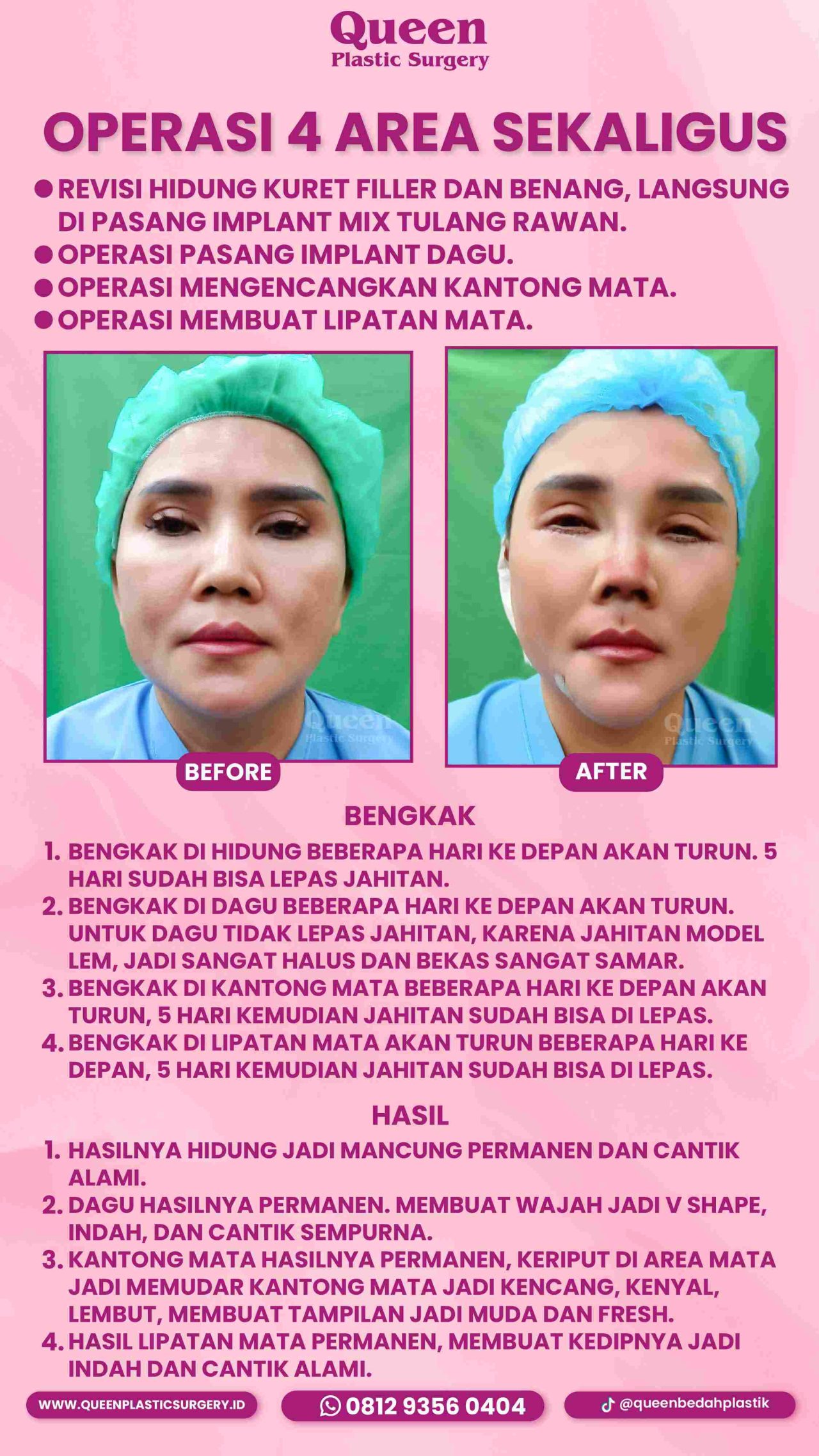 88 IGS -fotor-20240130112327