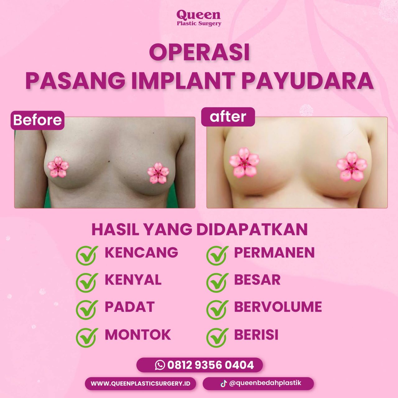 9 IGF