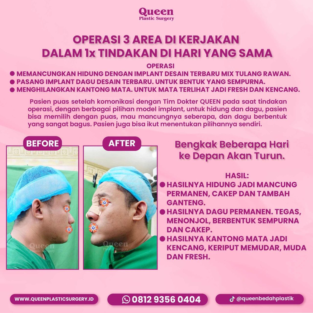 90 IGF-fotor-20240130114431