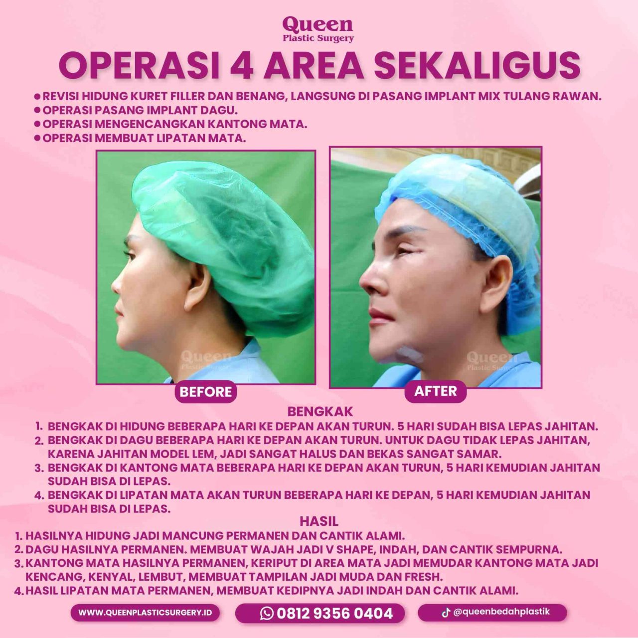 92 IGF-fotor-20240130114354