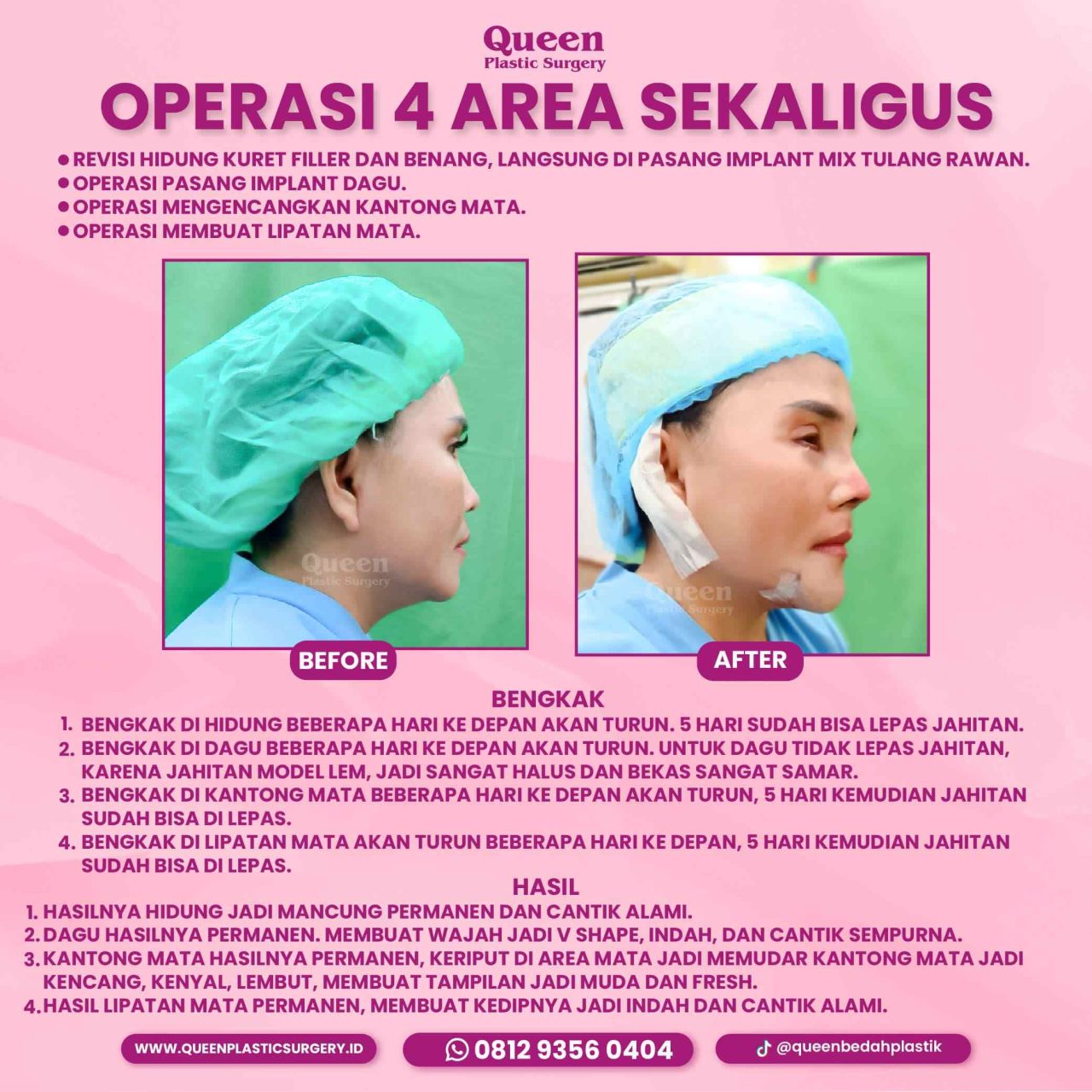 93 IGF-fotor-20240130114536