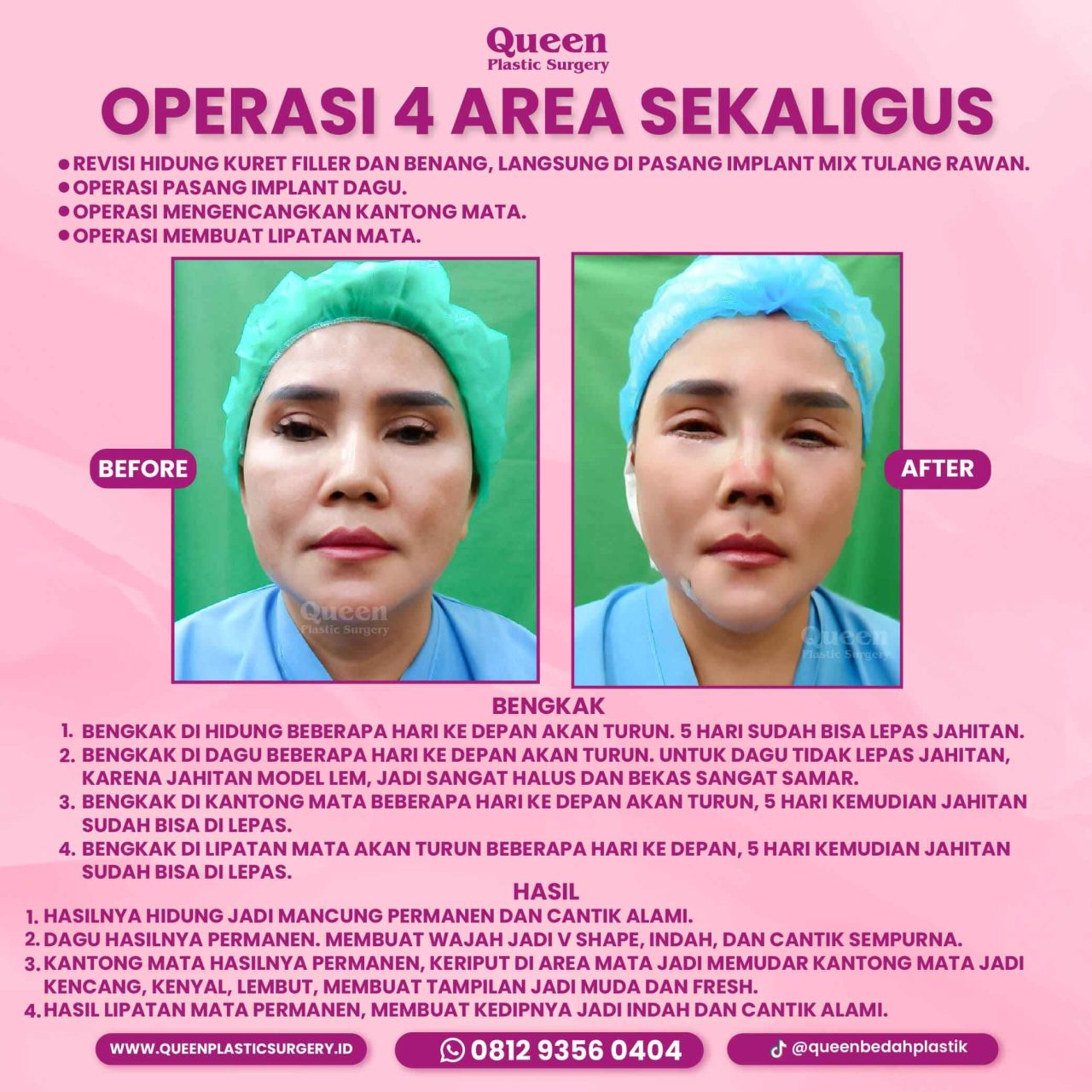 94 IGF-fotor-20240130114446