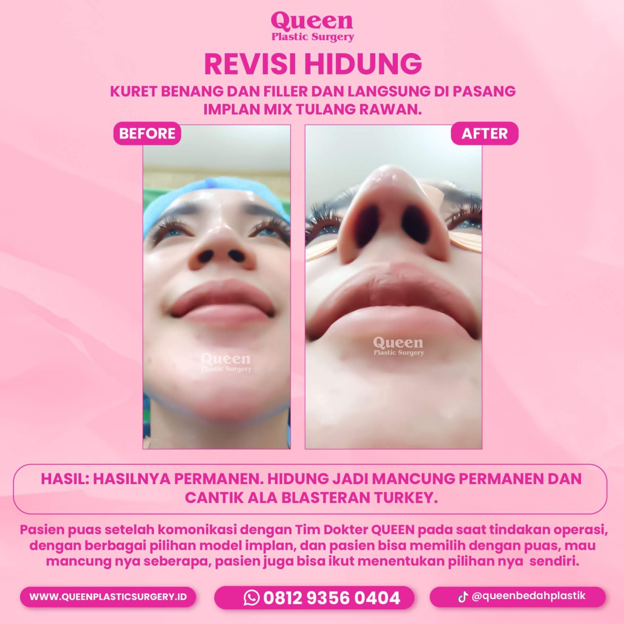 IGF TESTI PASIEN (13) (1) (2)