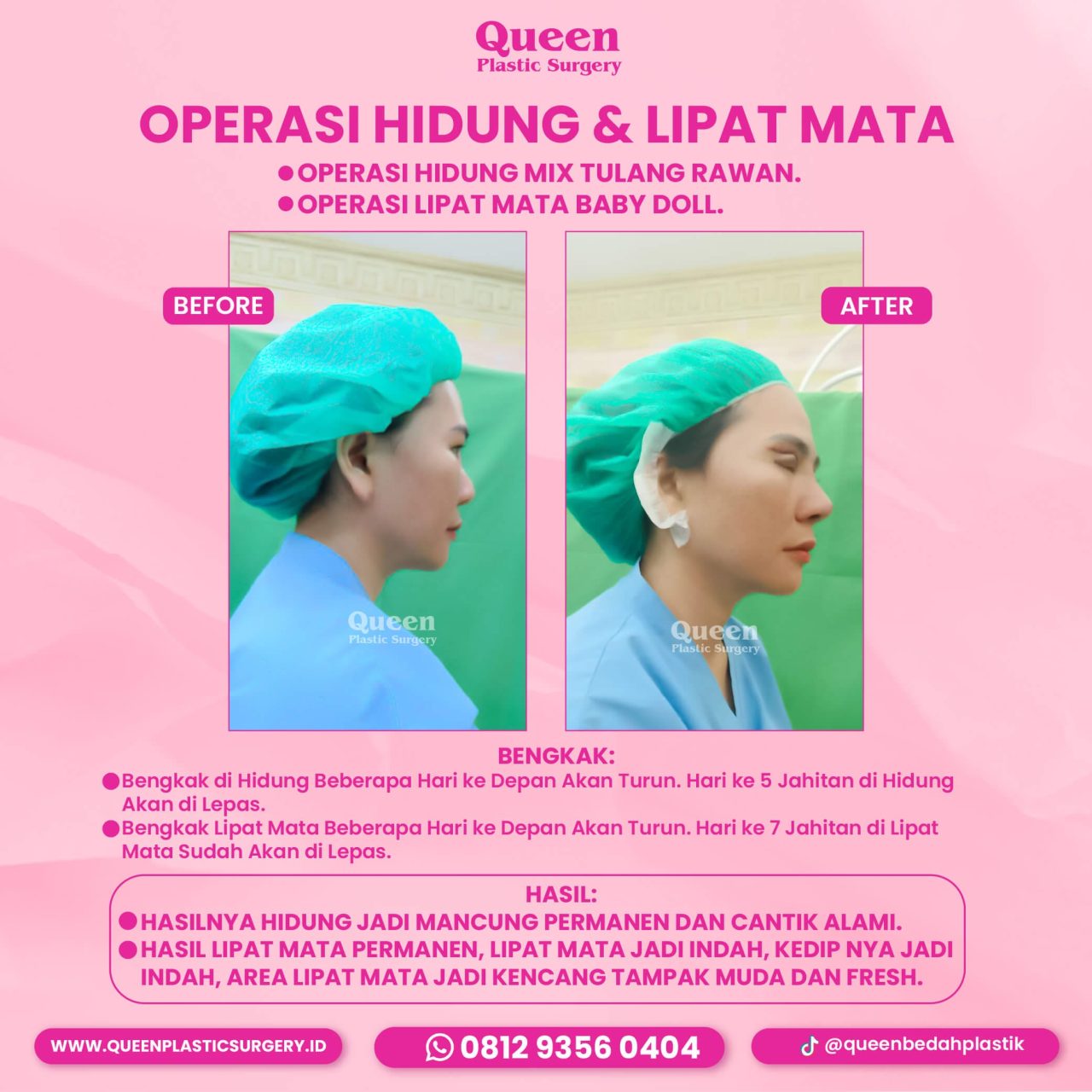 IGF TESTI PASIEN (2) (2) (1)