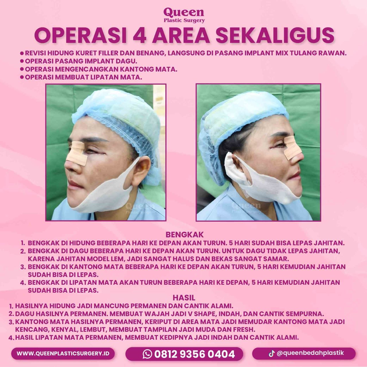 IGF TESTIMONI PASIEN-01 (1)-fotor-20240130114411