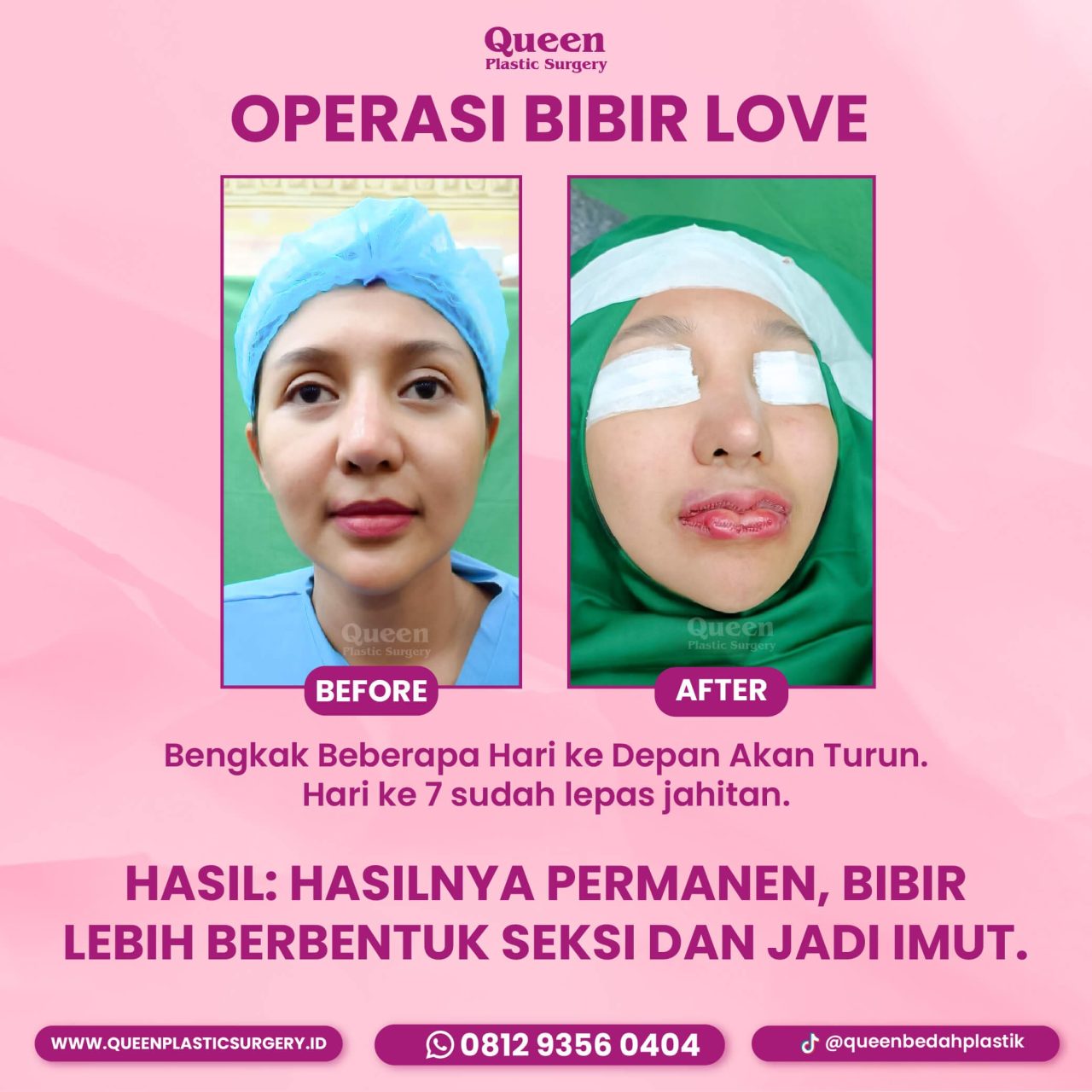 IGF TESTIMONI PASIEN-02 (1) IGF TESTIMONI PASIEN-02 (1)