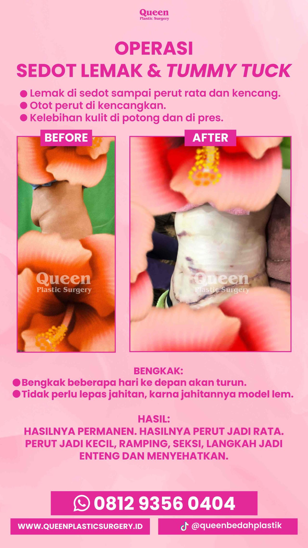 IGS TESTI PASIEN (1) (5) (1)-fotor-2024012913587