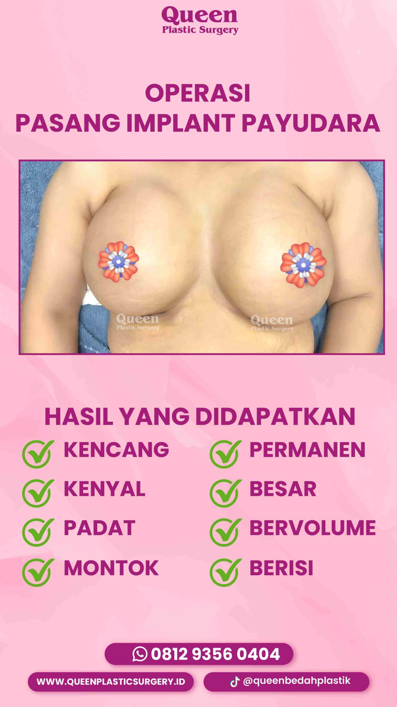 IGS TESTI PASIEN (11) (1) (1)-fotor-20240129163816
