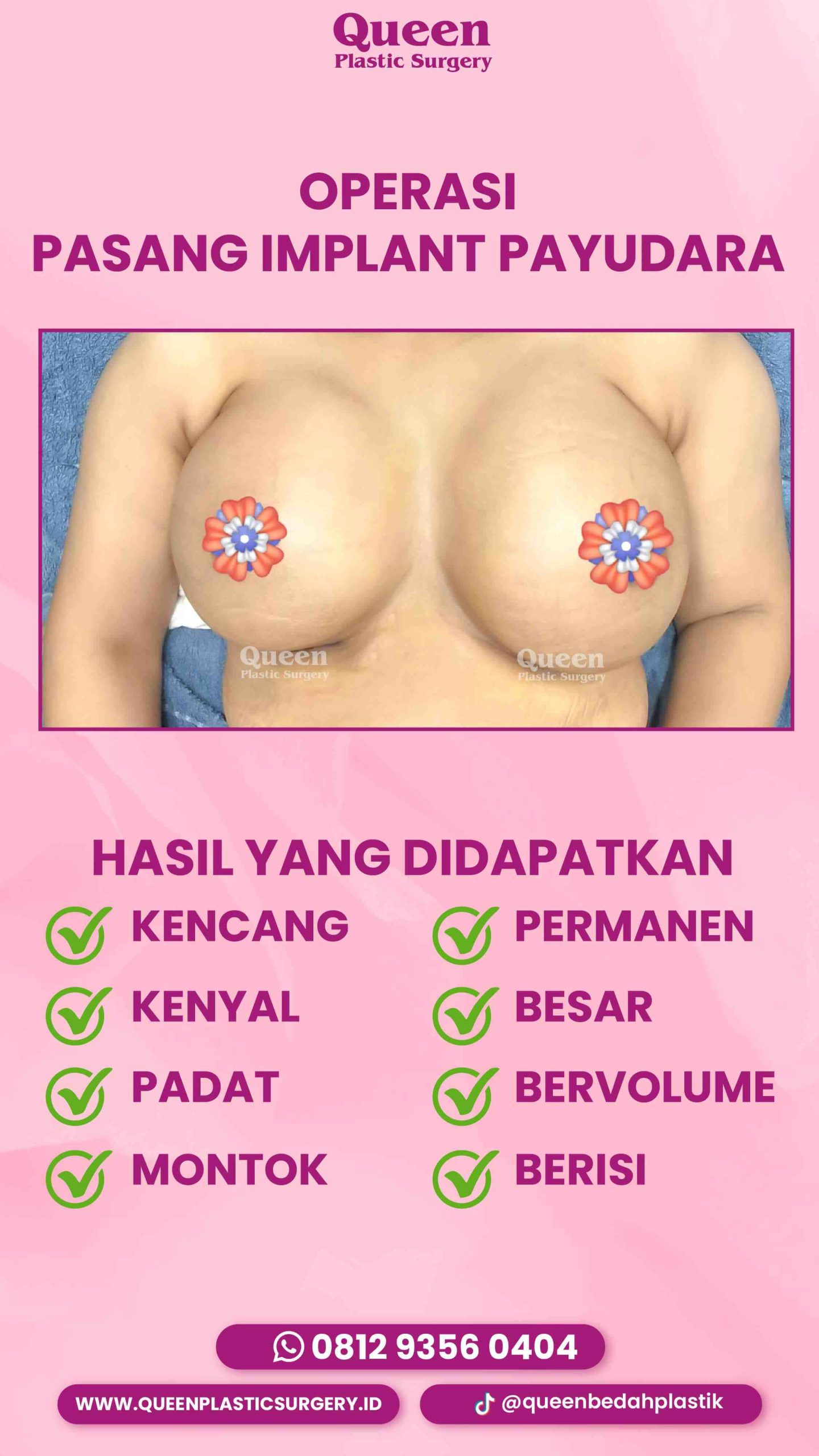 IGS TESTI PASIEN (11) (1) (1)-fotor-2024012917267