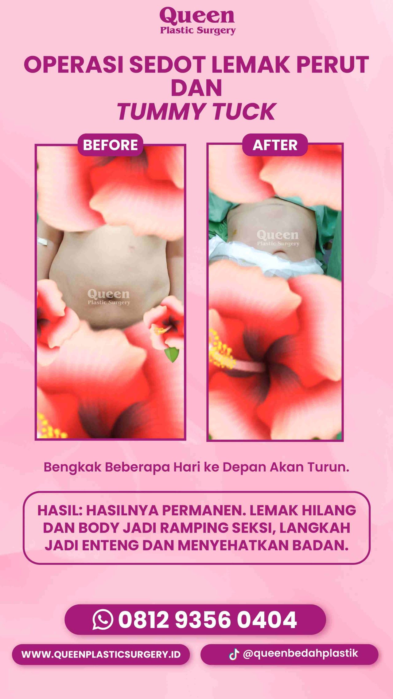 IGS TESTI PASIEN (13) (1)-fotor-20240129141643