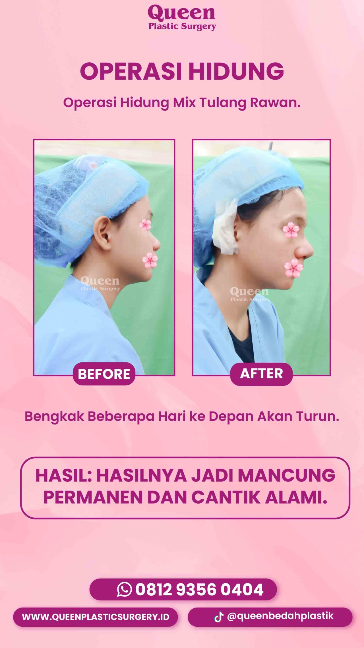IGS TESTI PASIEN (2) (16) (1)-fotor-2024013013045