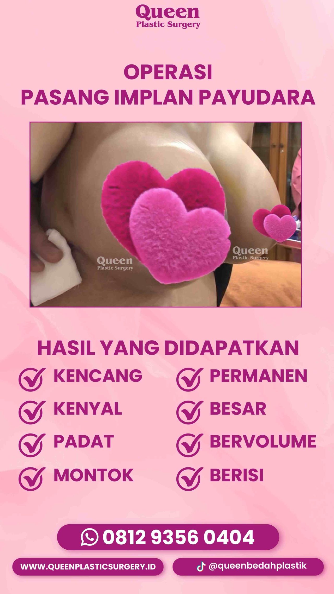 IGS TESTI PASIEN (3) (13) (1)-fotor-20240129172520