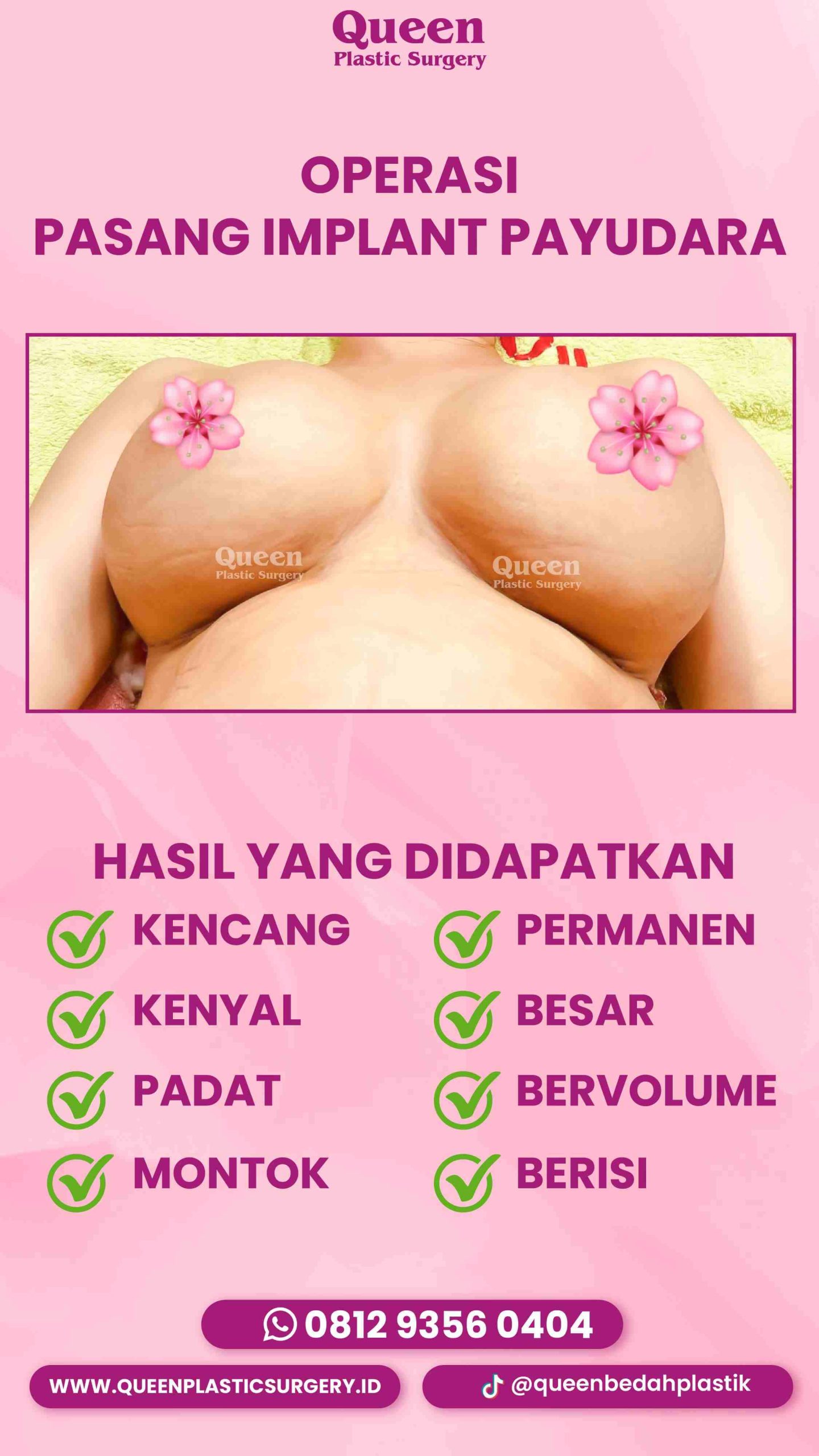 IGS TESTI PASIEN (3) (15) (1)-fotor-2024012916657