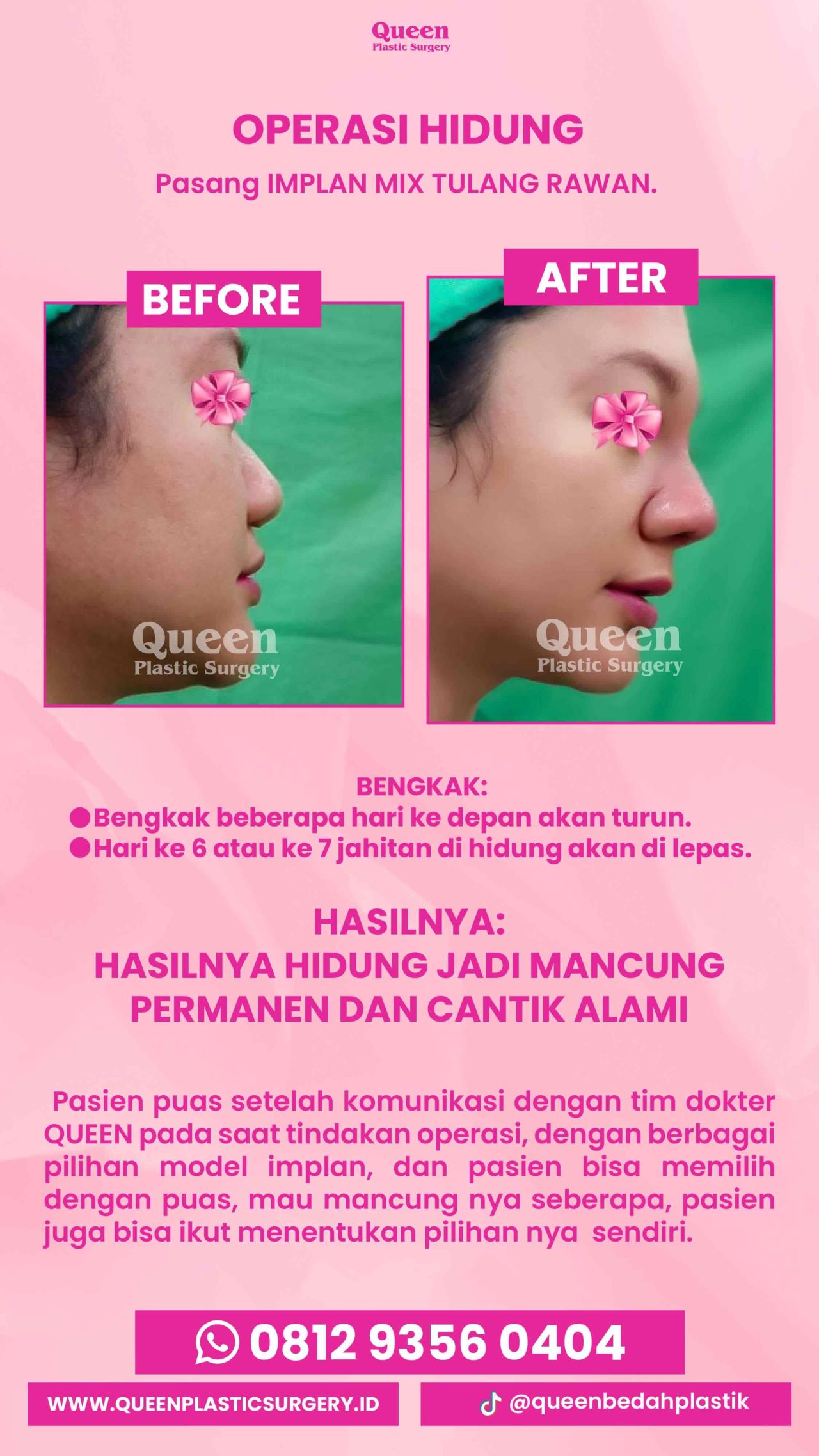 IGS TESTI PASIEN (3) (3) (1)-fotor-20240130125646