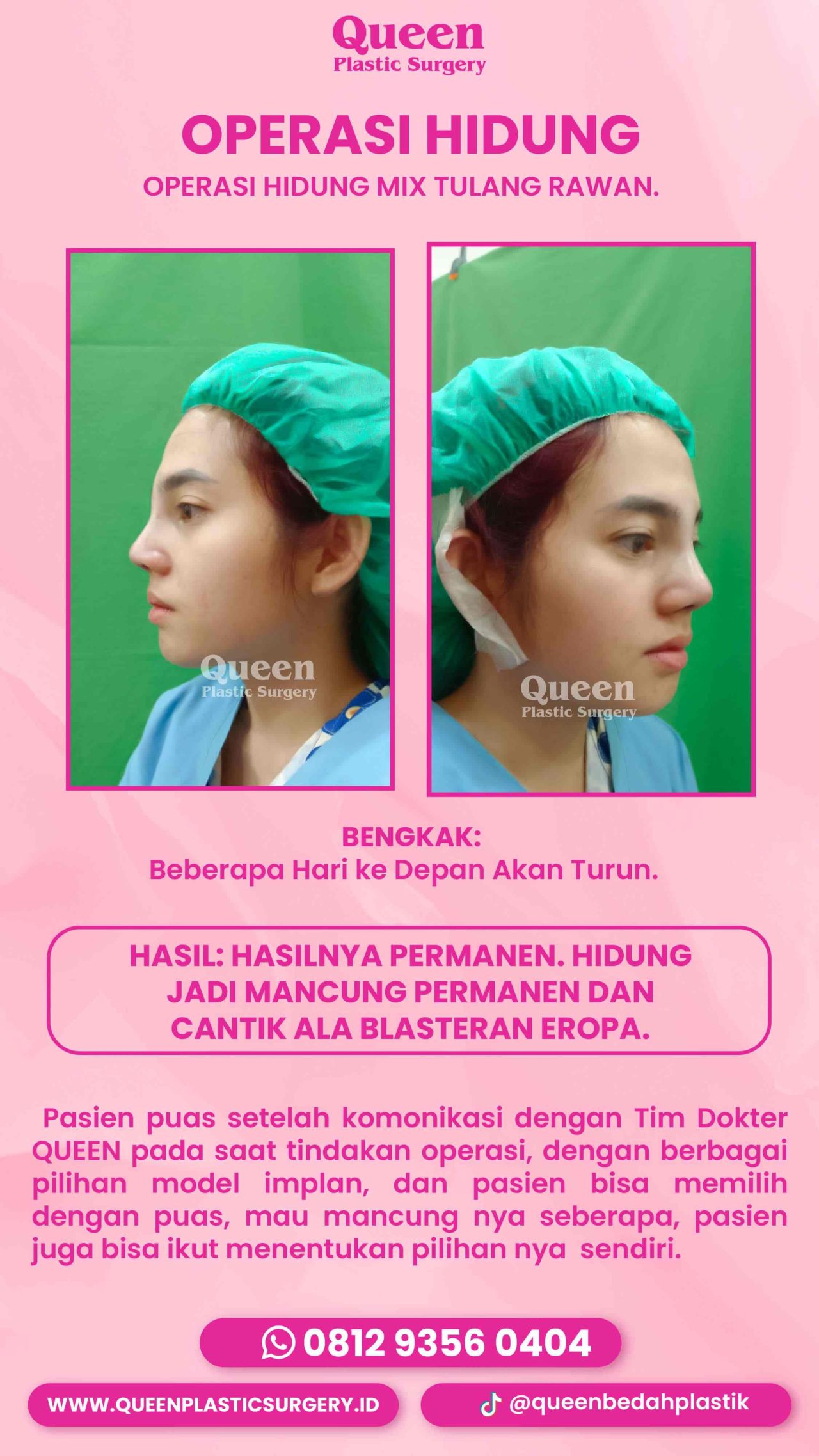 IGS TESTI PASIEN (4) (1) (1)-fotor-20240130123516