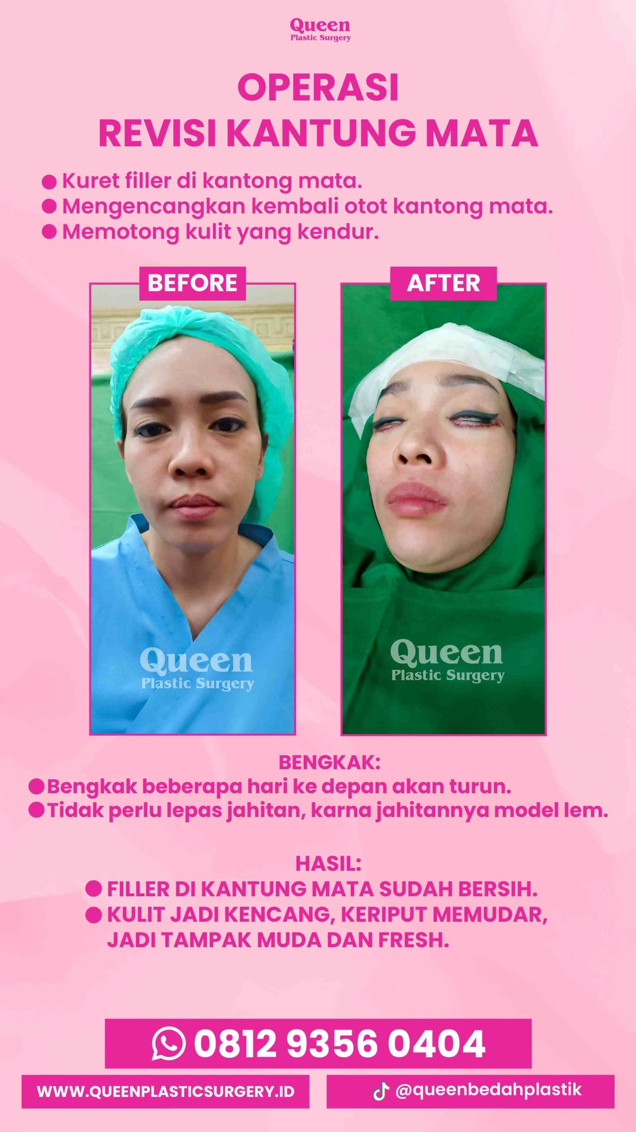 IGS TESTI PASIEN (6) (1) (1)-fotor-2024013011429