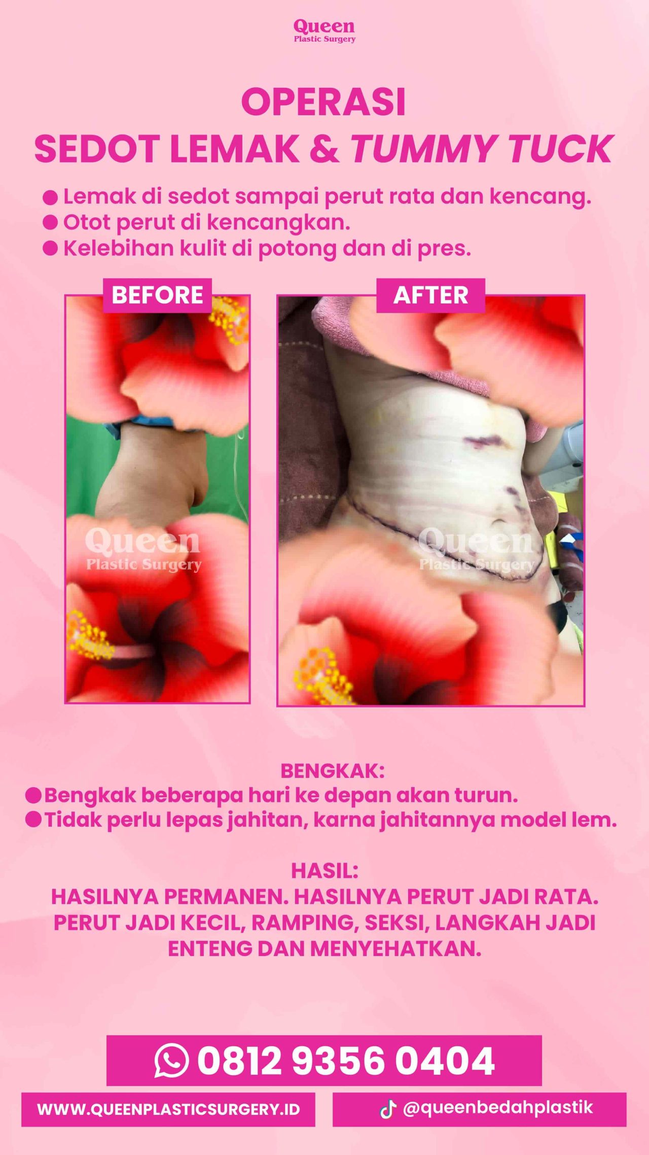 IGS TESTI PASIEN (7) (1) (1)-fotor-20240129141015