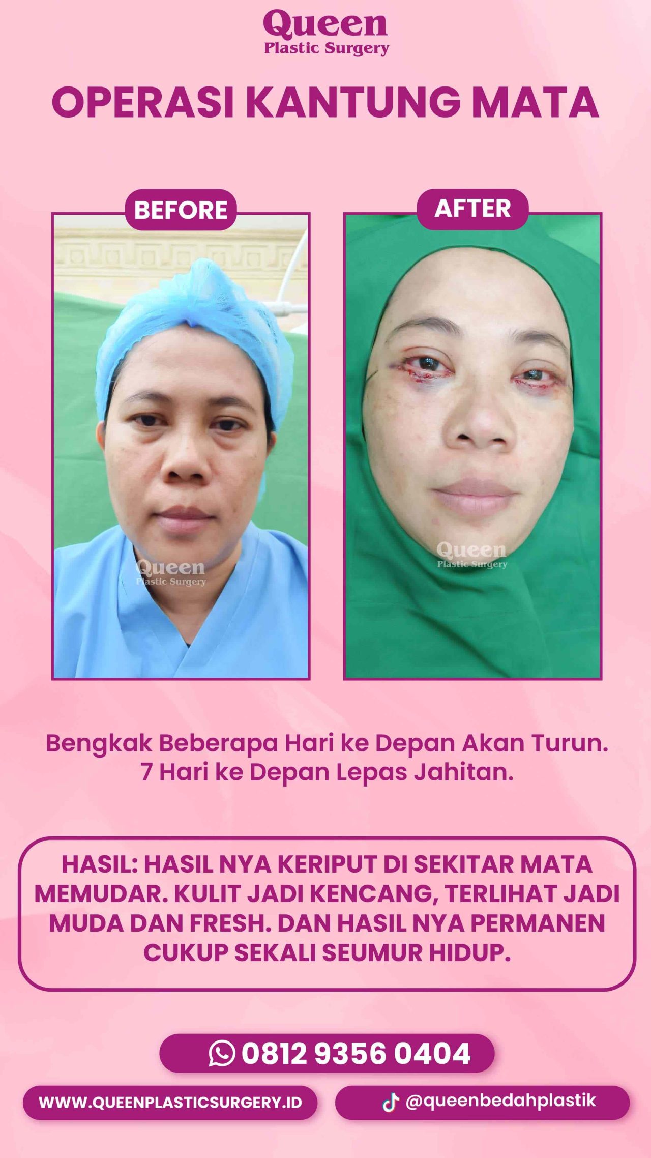 IGS TESTI PASIEN (7) (5) (1)-fotor-20240130114238