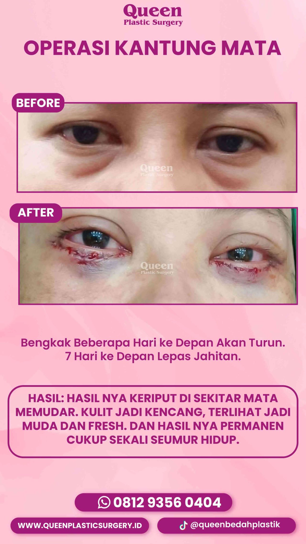 IGS TESTI PASIEN (8) (3) (1)-fotor-20240130114317