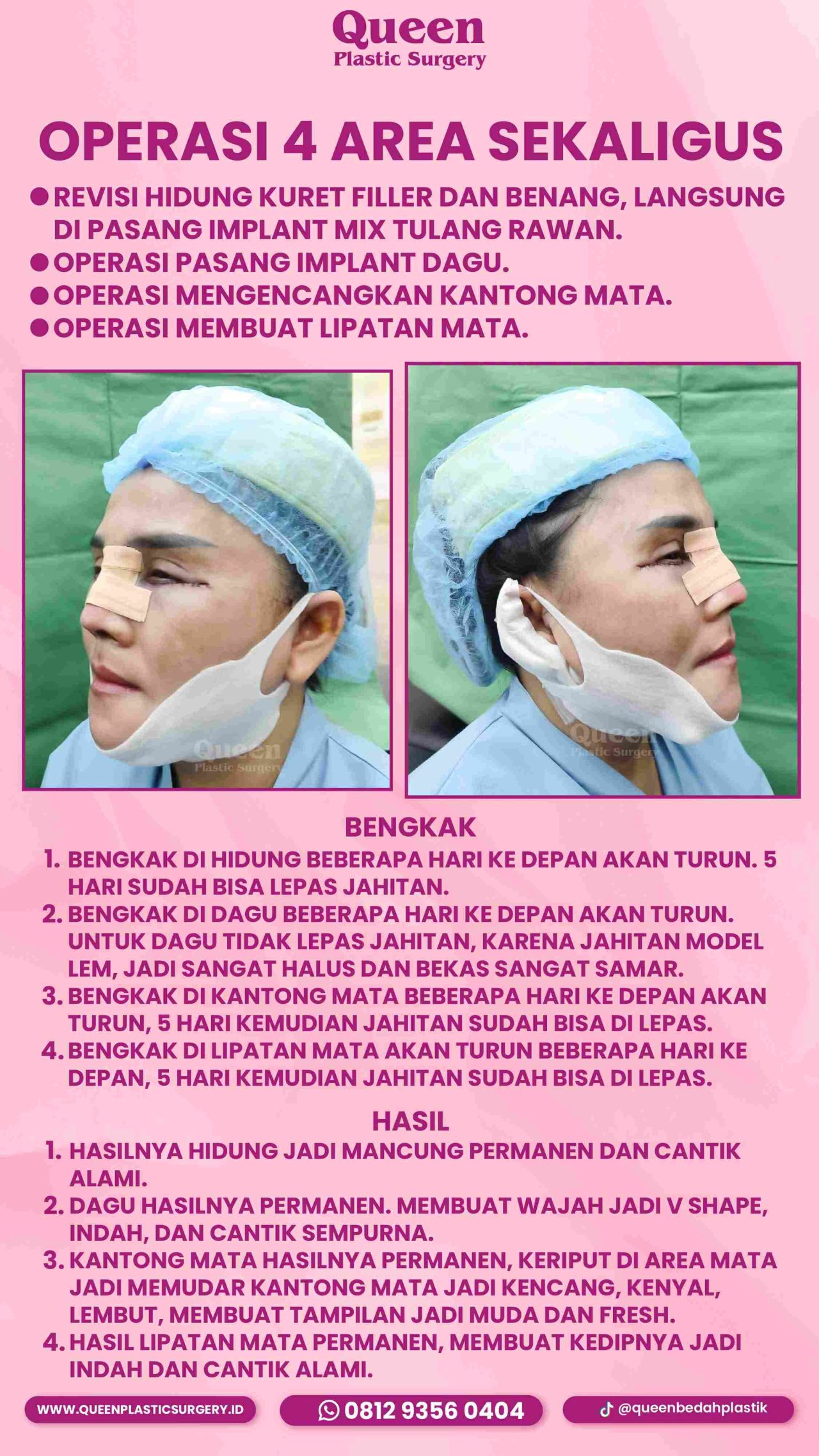 IGS TESTIMONI PASIEN_IGS 1 (1)-fotor-20240129151215