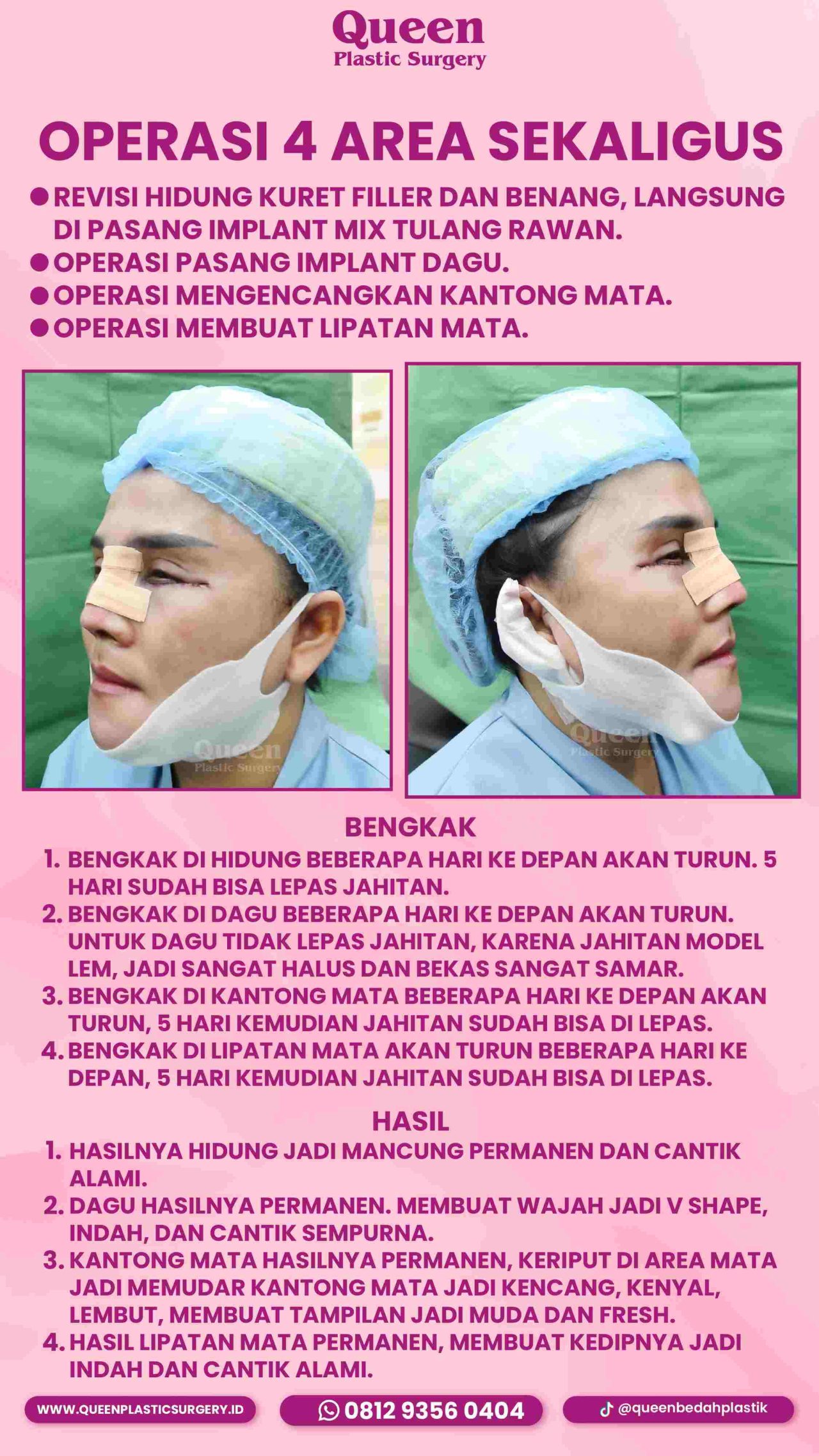 IGS TESTIMONI PASIEN_IGS 1 (1)-fotor-20240130112342