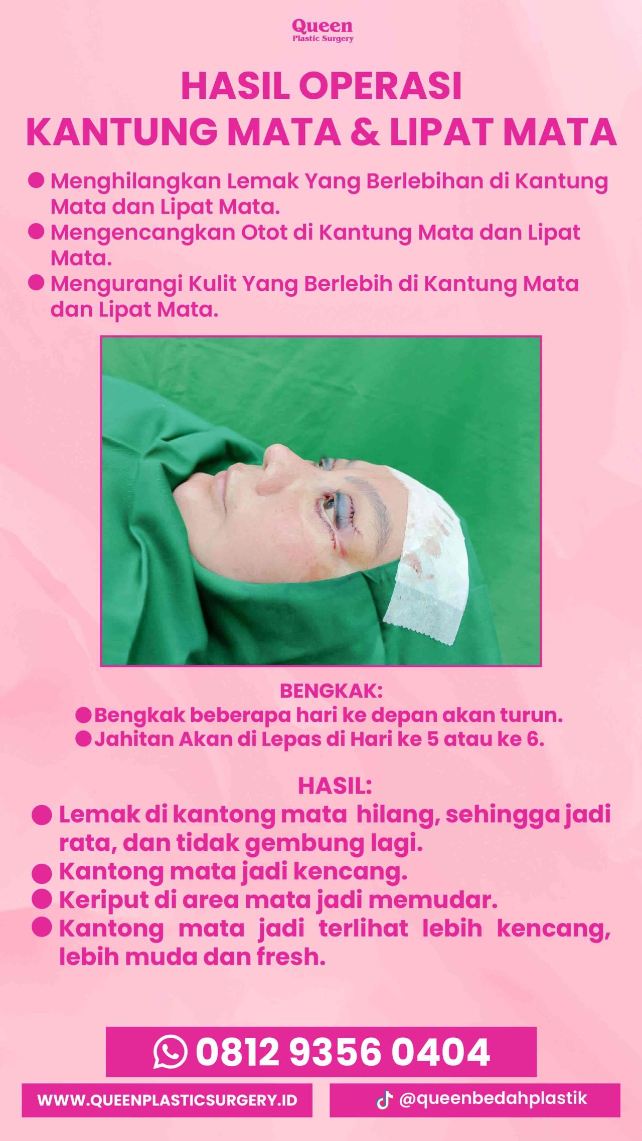 IGS testi pasien (1) (17) (1)-fotor-20240130114053