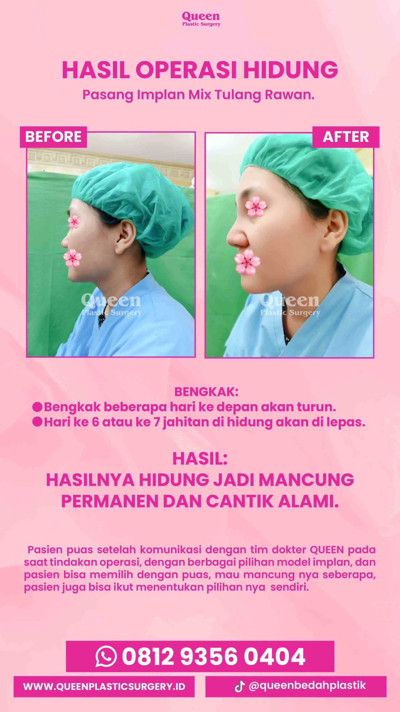 IGS testi pasien (2) (17) (1)-fotor-20240130125711