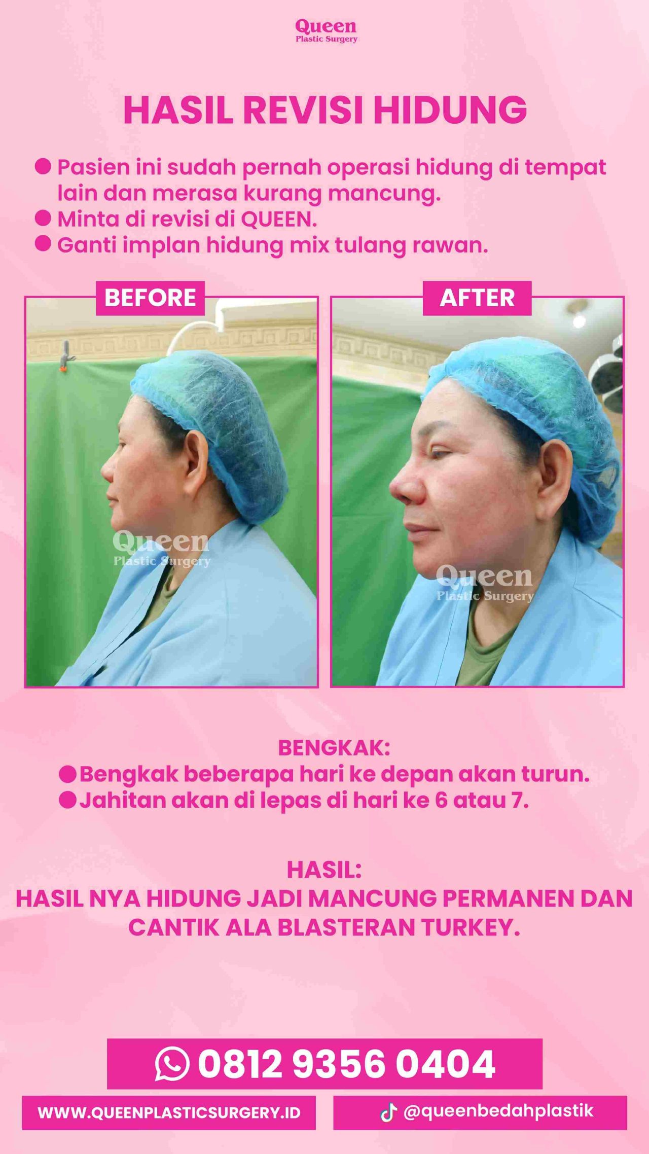 IGS testi pasien (3) (15) (1)-fotor-20240129144211