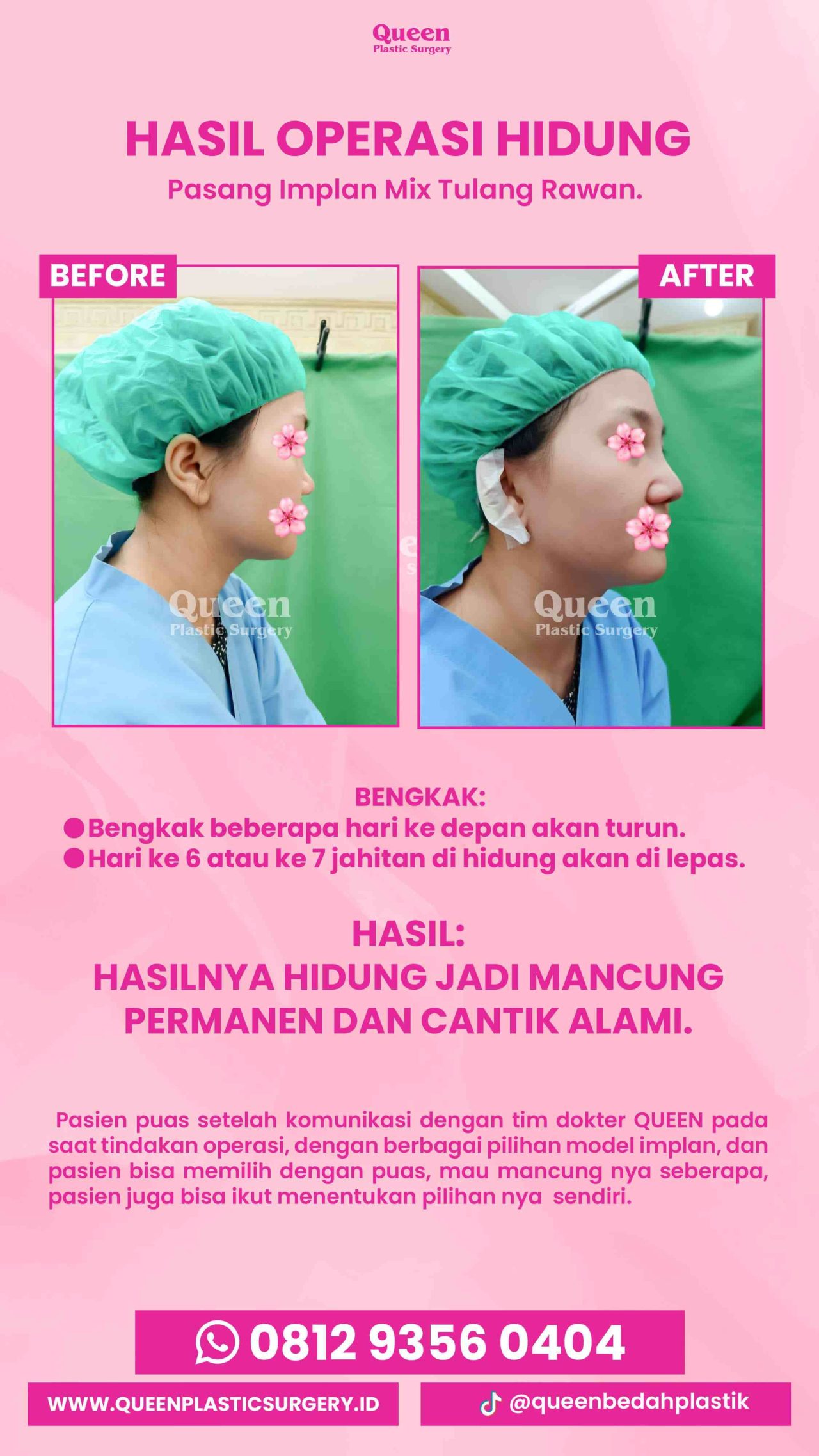 IGS testi pasien (3) (16) (1)-fotor-20240130125810