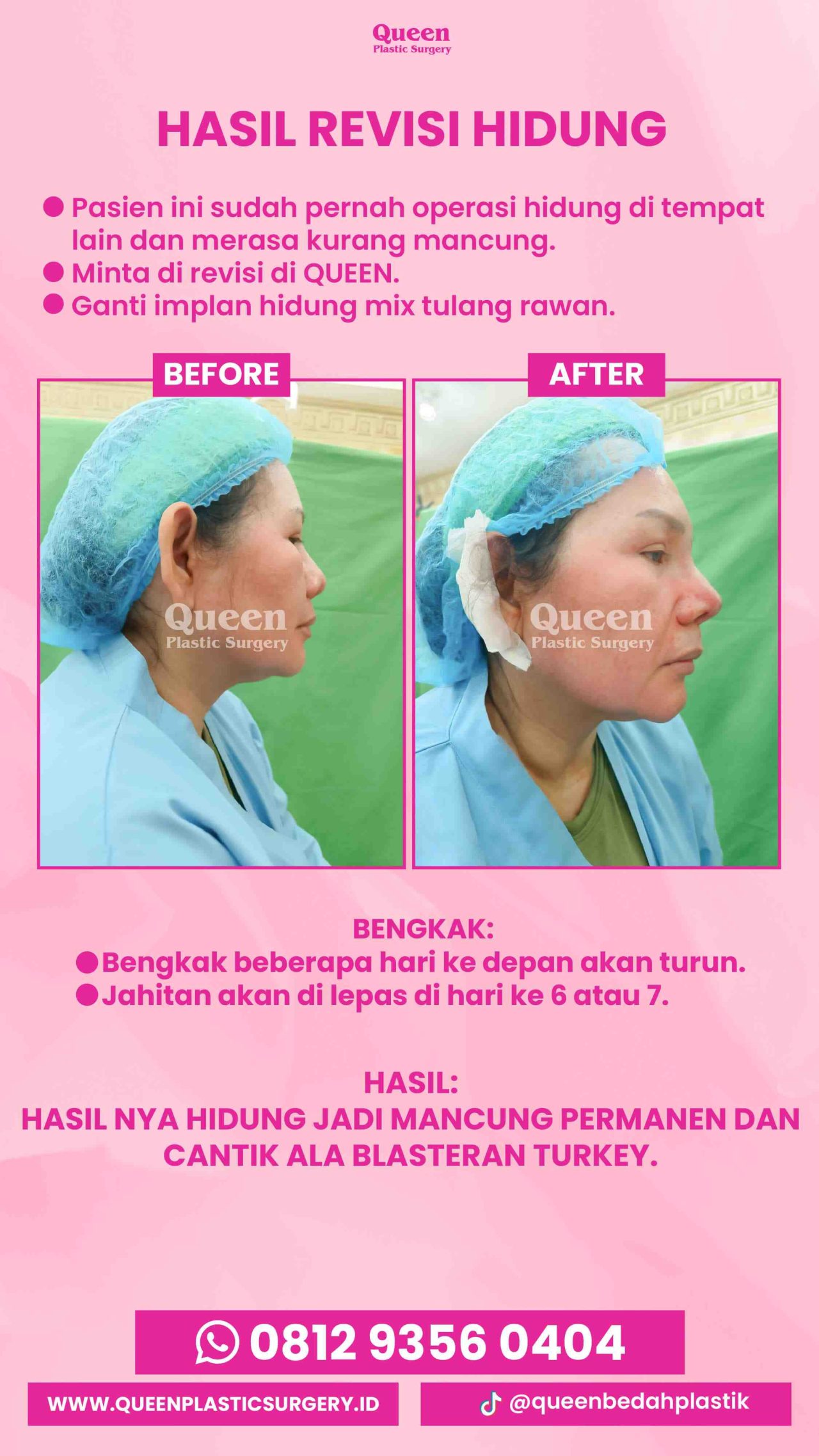 IGS testi pasien (4) (15) (1)-fotor-20240129144316