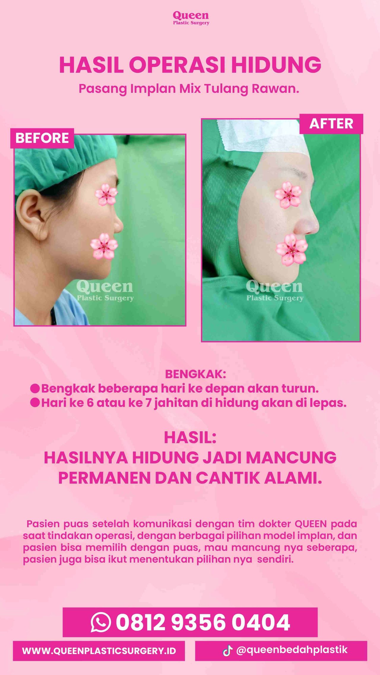 IGS testi pasien (4) (16) (1)-fotor-2024013013112