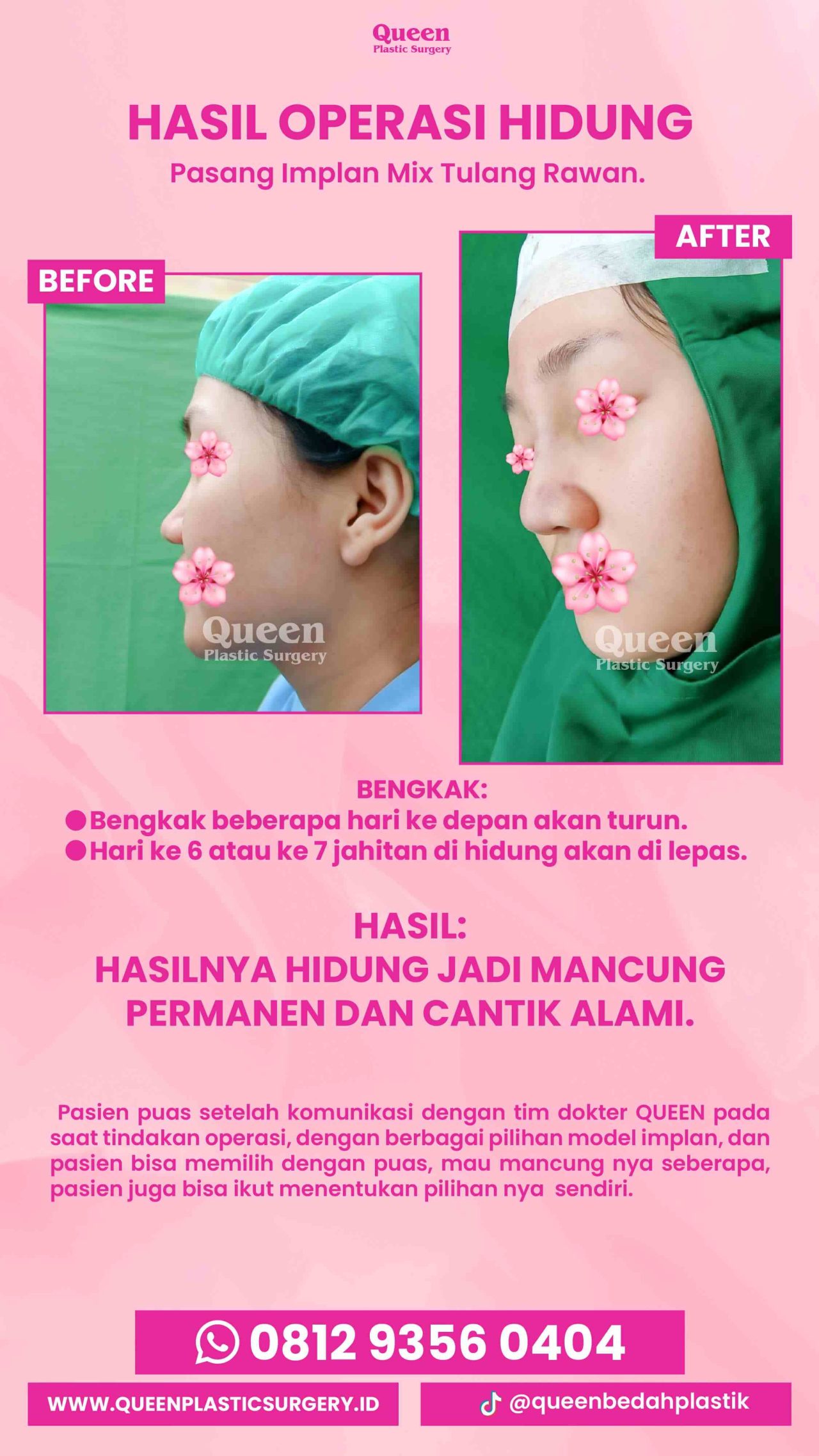 IGS testi pasien (5) (12) (1)-fotor-20240130125912