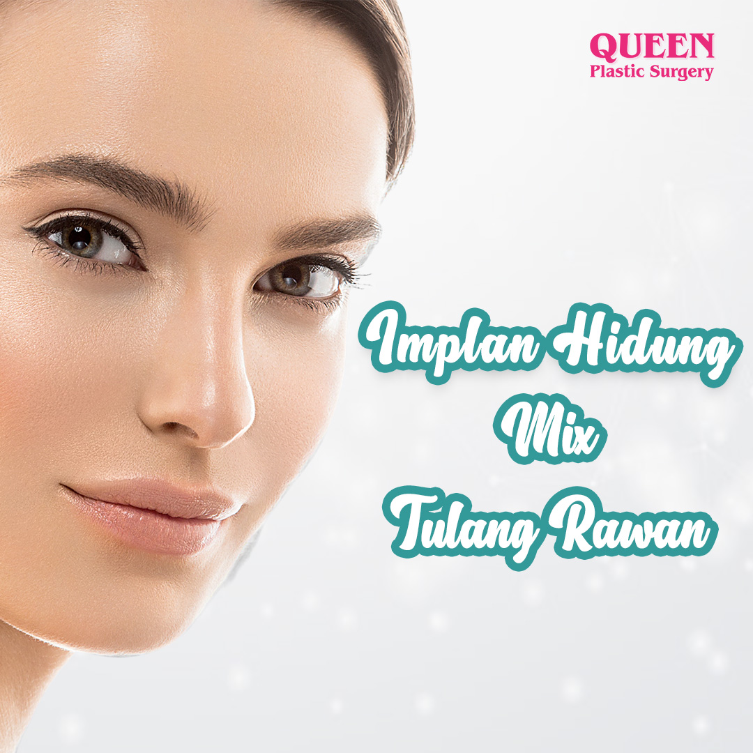 https://queenplasticsurgery.id/wp-content/uploads/2024/01/Implan-Hidung-Mix-Tulang-Rawan.jpg