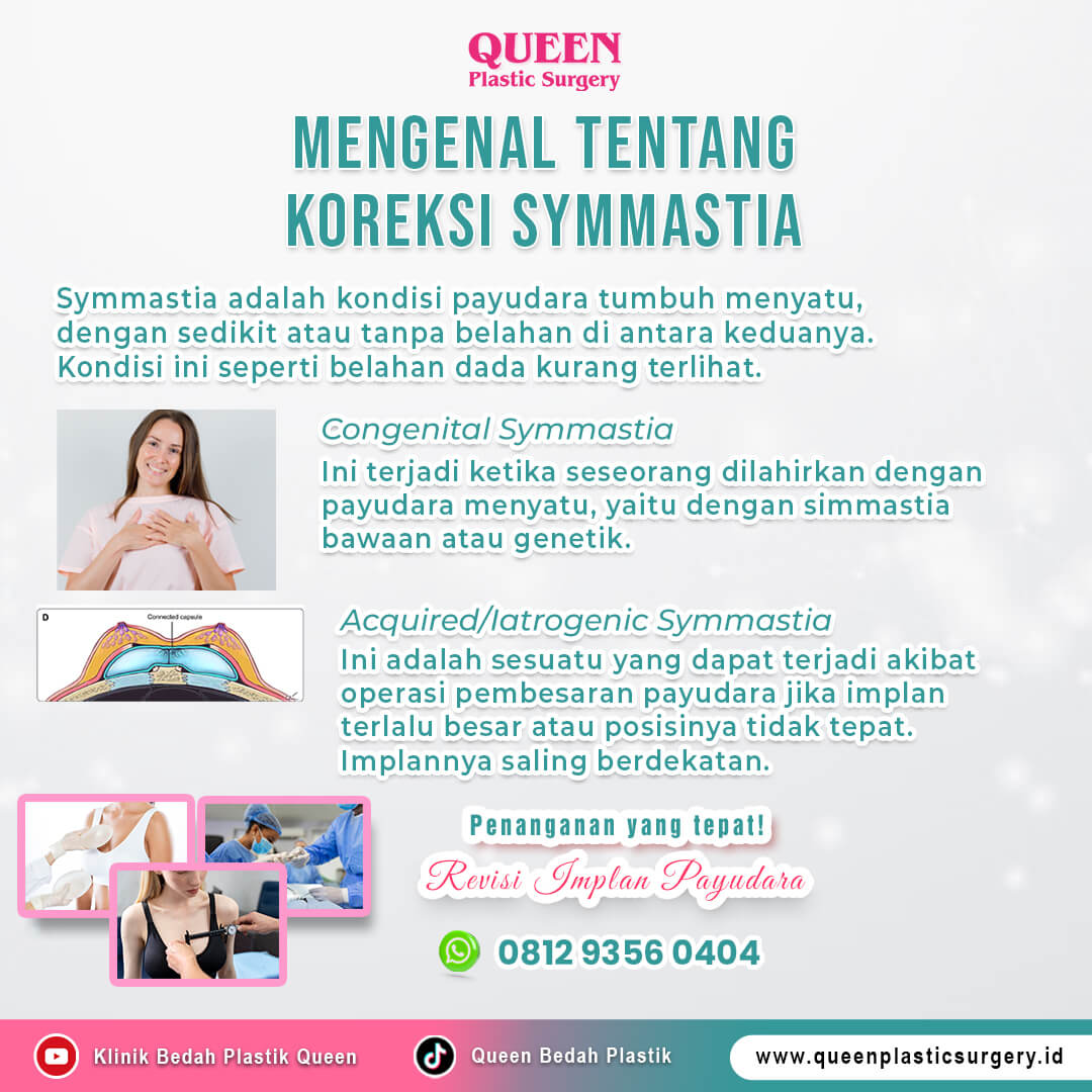 Mengenal-Tentang-Koreksi-Symmastia-Queen-Web (1) (1)