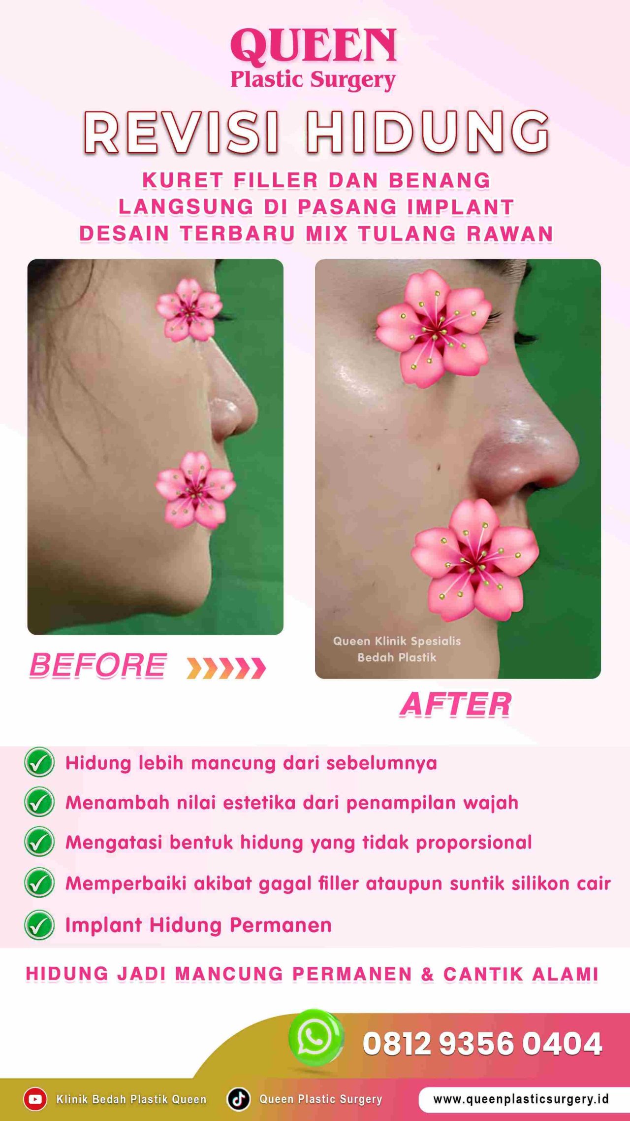 New-Revisi-Hidung-InovGlow-IGS-004 (1)-fotor-2024012914537