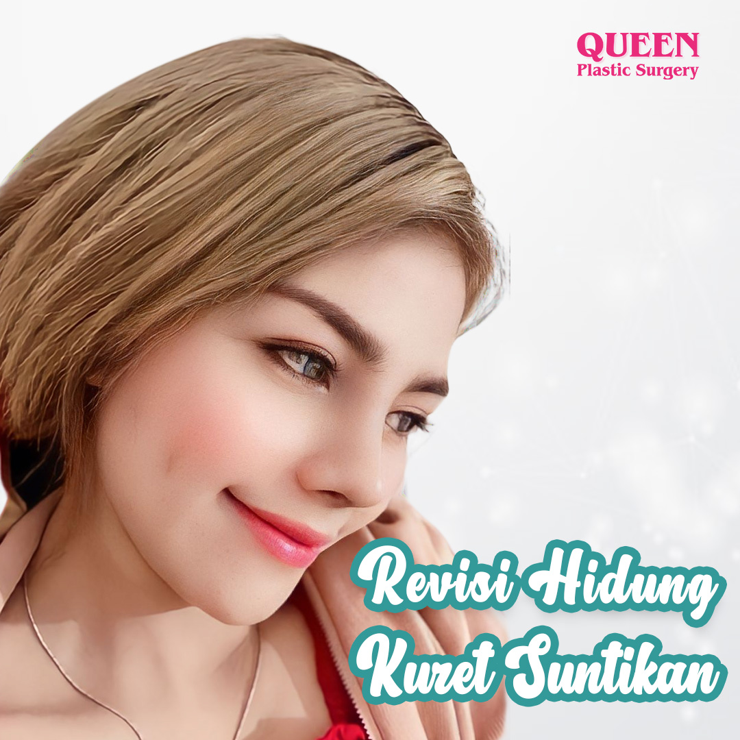 https://queenplasticsurgery.id/wp-content/uploads/2024/01/Revisi-Hidung-Kuret-Suntikan.jpg