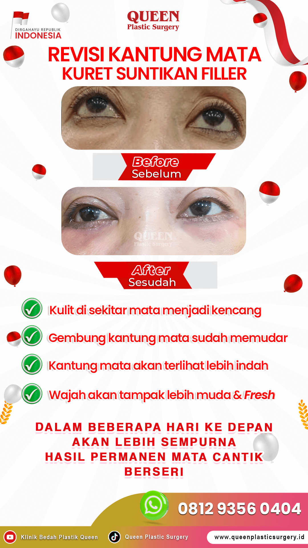 Revisi-Kantung-Mata-Queen-IGS-002 (1)