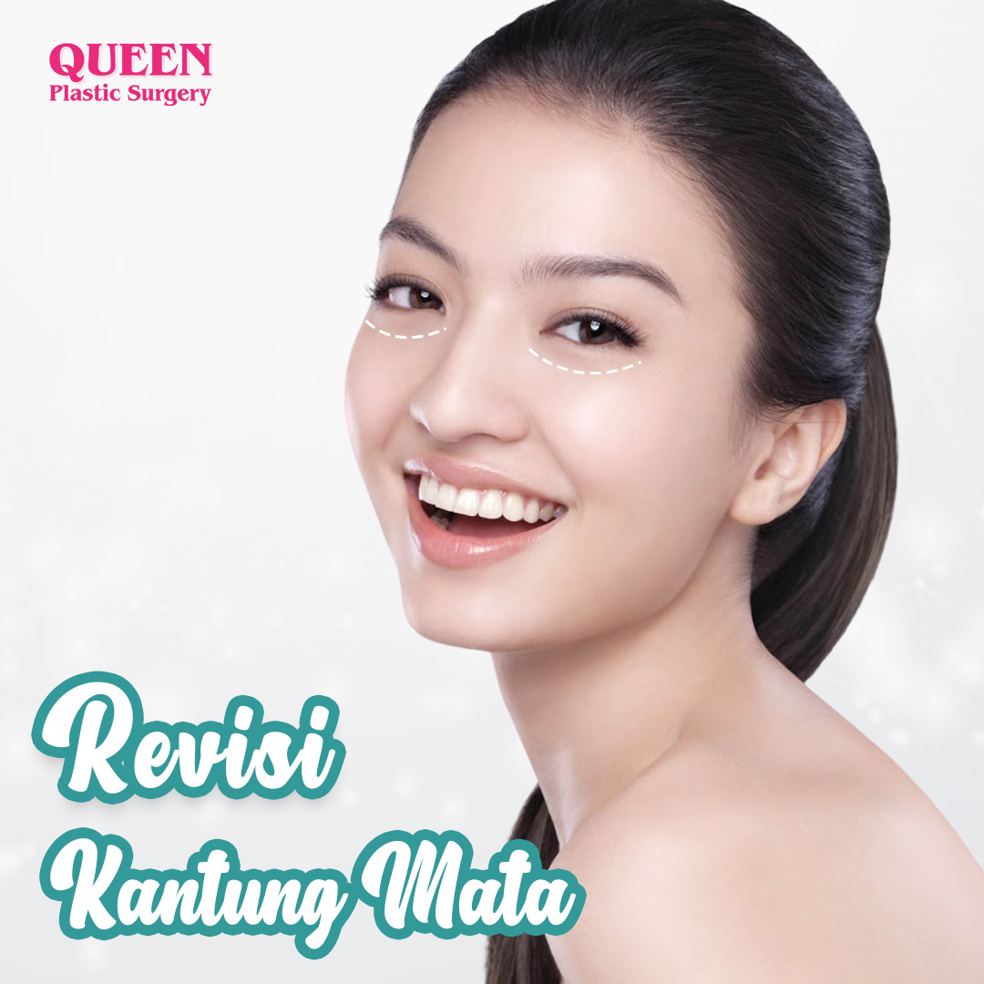 https://queenplasticsurgery.id/wp-content/uploads/2024/01/Revisi-Kantung-Mata-Web.jpg