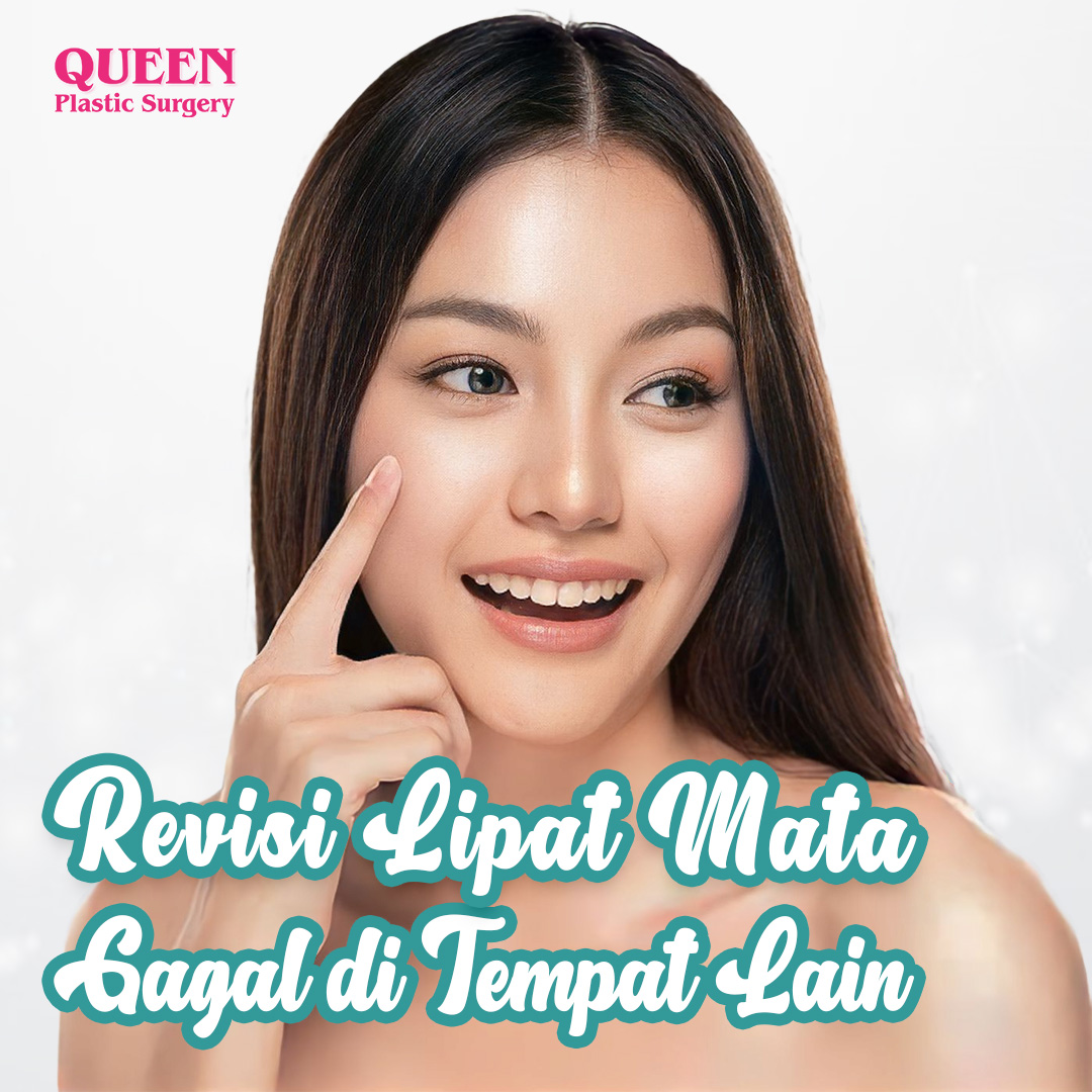 https://queenplasticsurgery.id/wp-content/uploads/2024/01/Revisi-Lipat-Mata-Gagal-di-Tempat-Lain-Web.jpg