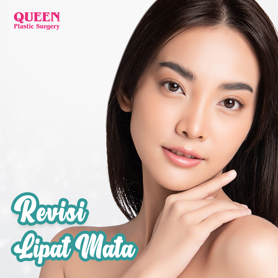 https://queenplasticsurgery.id/wp-content/uploads/2024/01/Revisi-Lipat-Mata-Thumbnail-Web.jpg