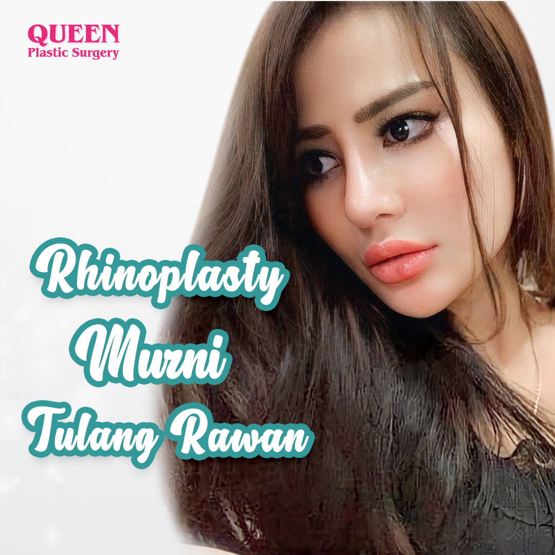 https://queenplasticsurgery.id/wp-content/uploads/2024/01/Rhinoplasty-Murni-Tulang-Rawan.jpg