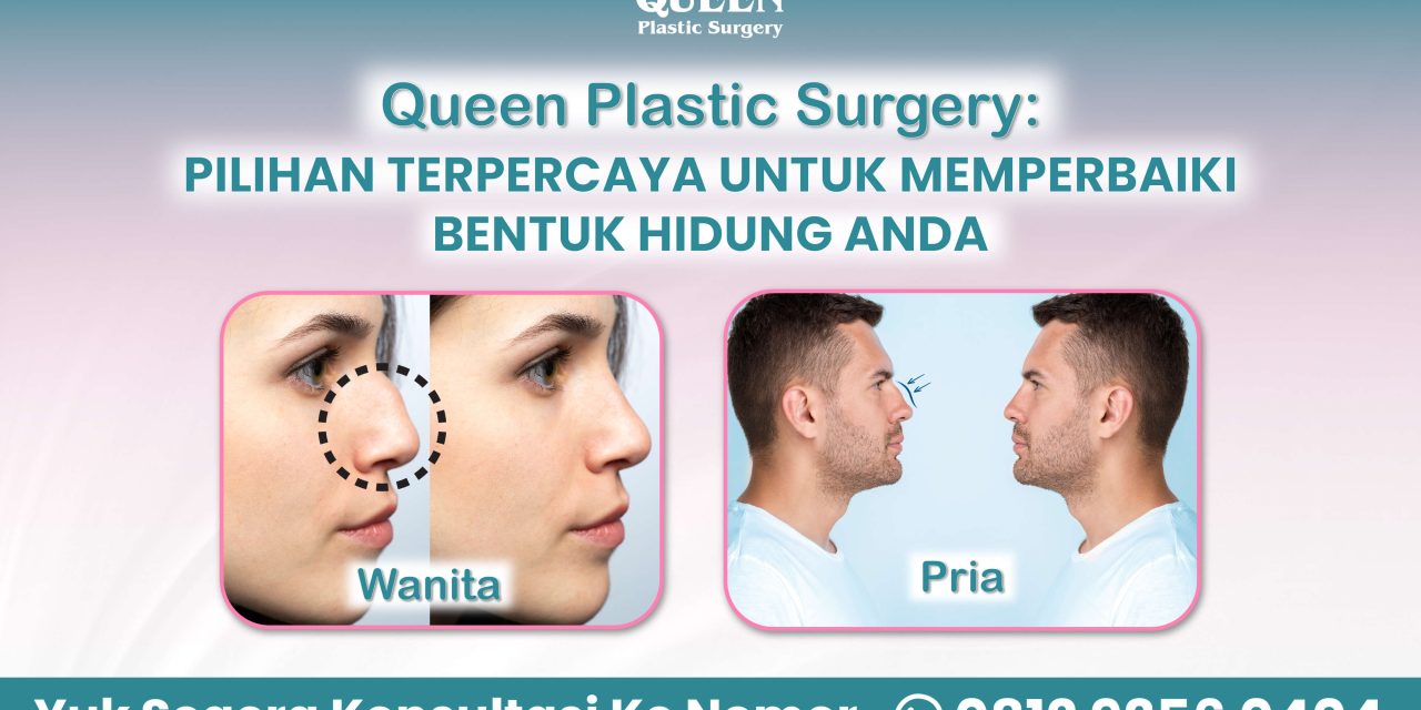 PROSEDUR RHINOPLASTY DAN HASIL YANG TERLIHAT ALAMI